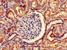 Immunohistochemistry of paraffin-embedded human kidney tissue using CSB-PA022332LA01HU at dilution of 1:100
