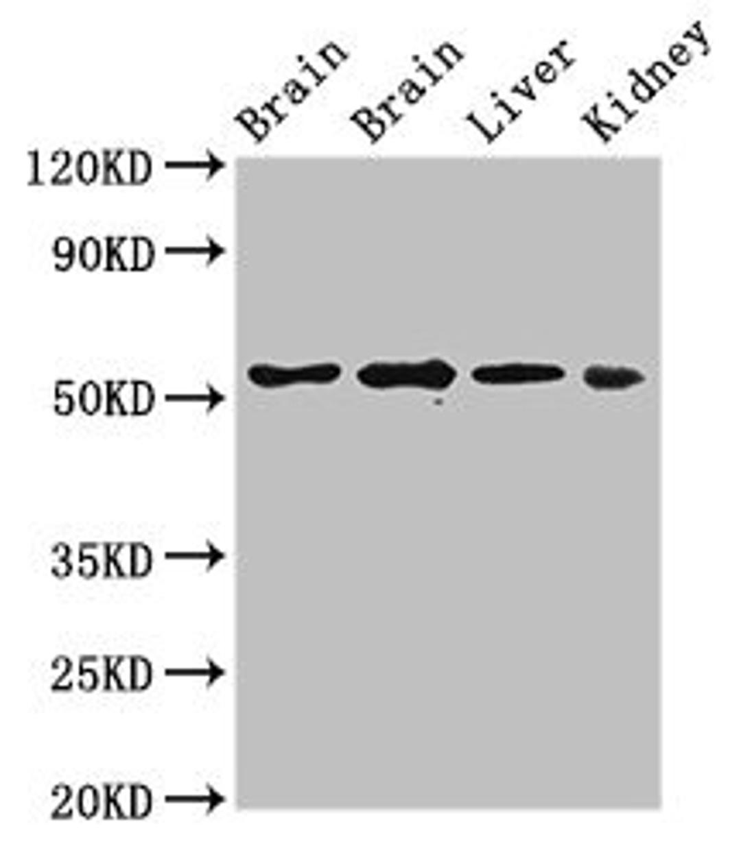 Western Blot. Positive WB detected in: Rat brain tissue, Mouse brain tissue, Mouse liver tissue, Mouse kidney tissue. All lanes: PPP2R2A antibody at 3ug/ml. Secondary. Goat polyclonal to rabbit IgG at 1/50000 dilution. Predicted band size: 52, 53 kDa. Observed band size: 52 kDa.