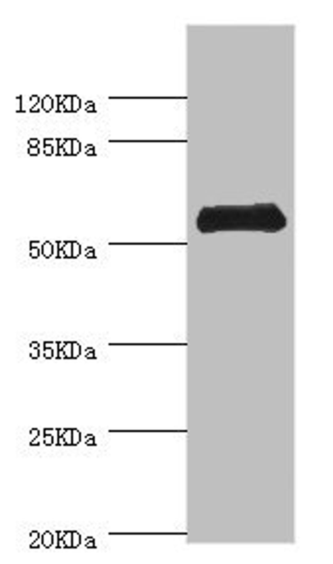 Western blot. All lanes: CHIA antibody at 0.74ug/ml + Mouse stomach tissue. Secondary. Goat polyclonal to rabbit IgG at 1/10000 dilution. Predicted band size: 53, 41, 34 kDa. Observed band size: 53 kDa. 