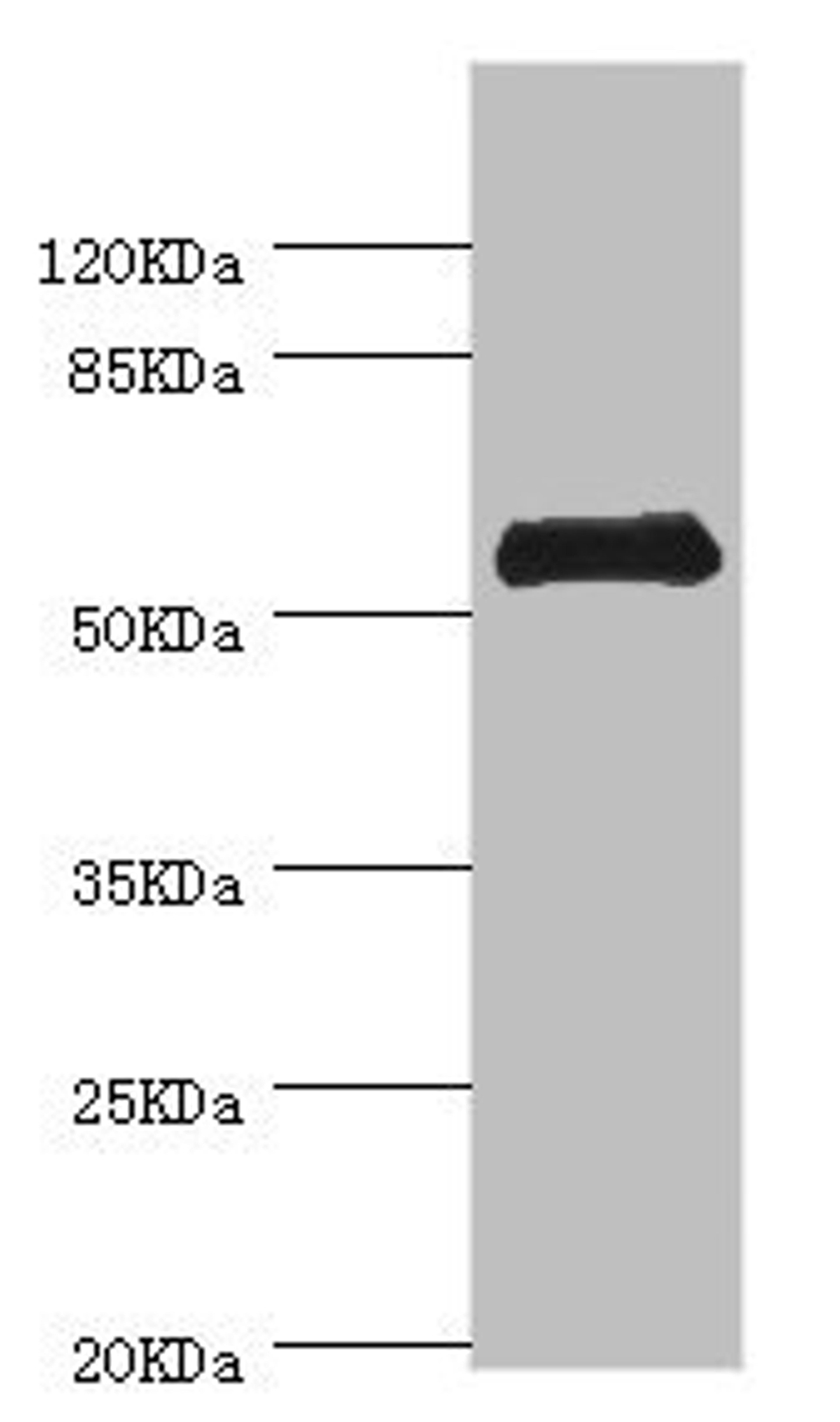 Western blot. All lanes: CHIA antibody at 0.74ug/ml + Mouse stomach tissue. Secondary. Goat polyclonal to rabbit IgG at 1/10000 dilution. Predicted band size: 53, 41, 34 kDa. Observed band size: 53 kDa. 