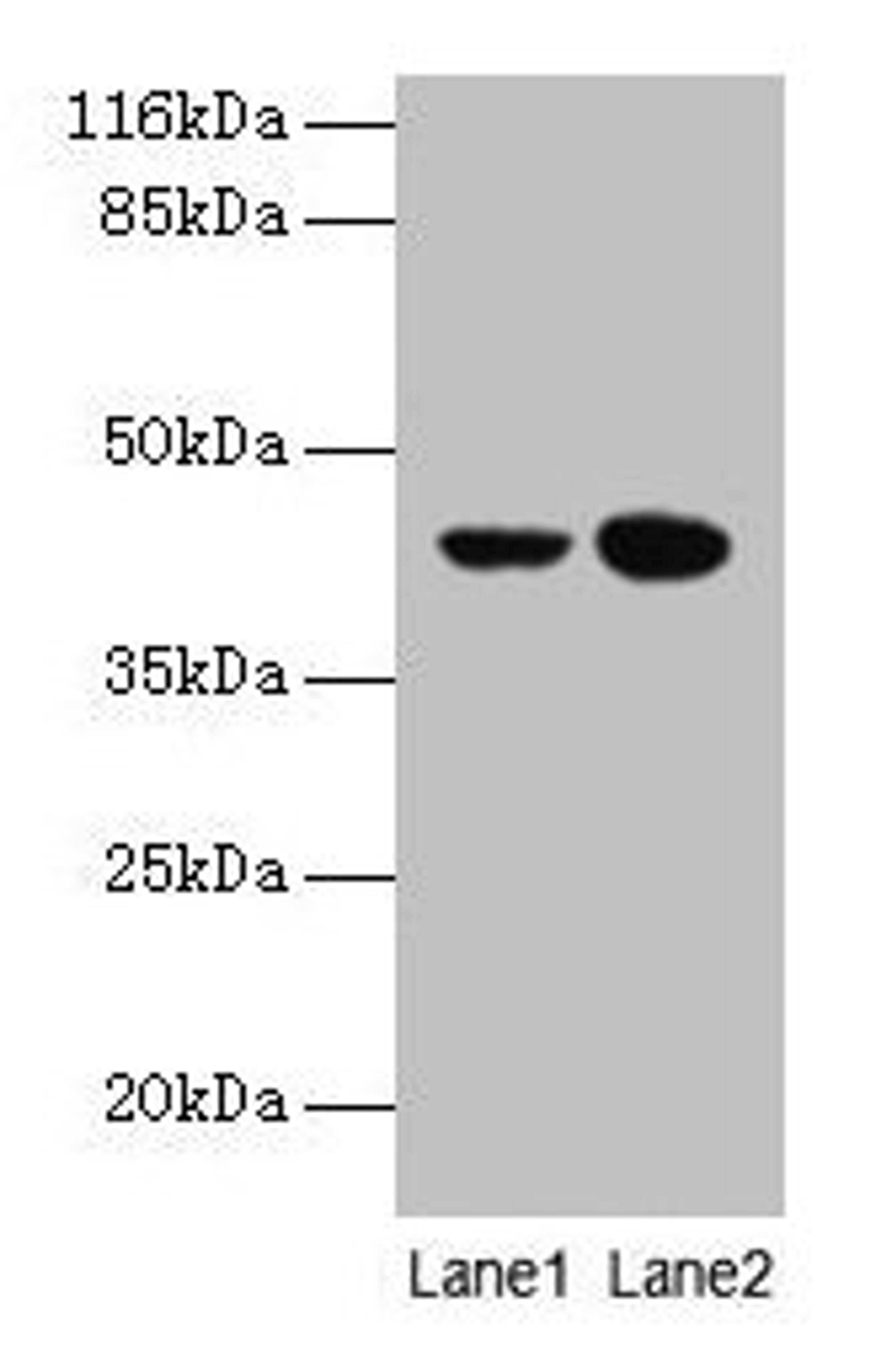 Western blot. All lanes: CCR6 antibody at 10µg/ml. Lane 1: MCF-7 whole cell lysate. Lane 2: Hela whole cell lysate. Secondary. Goat polyclonal to rabbit IgG at 1/10000 dilution. Predicted band size: 43 kDa. Observed band size: 43 kDa