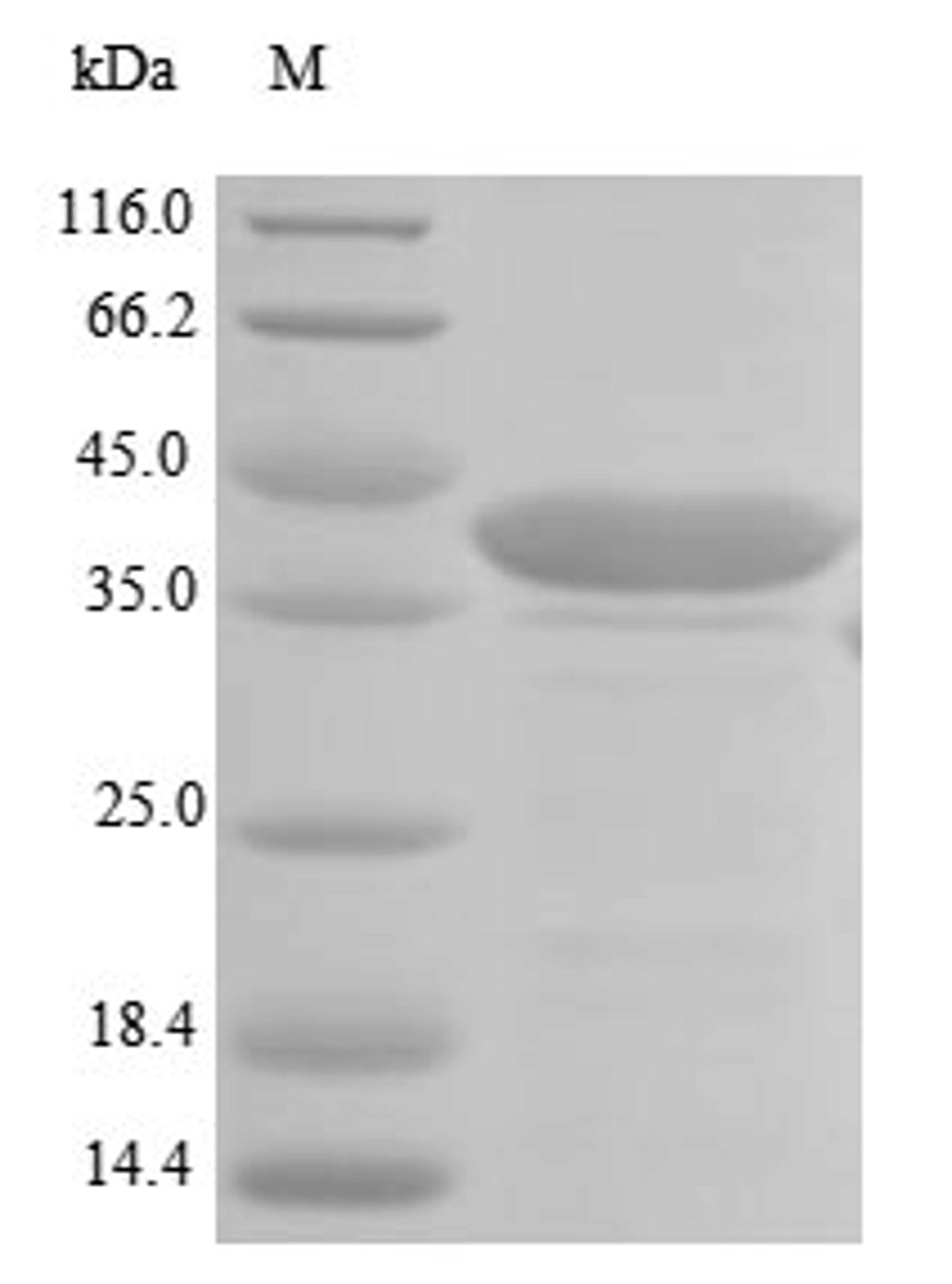 (Tris-Glycine gel) Discontinuous SDS-PAGE (reduced) with 5% enrichment gel and 15% separation gel.