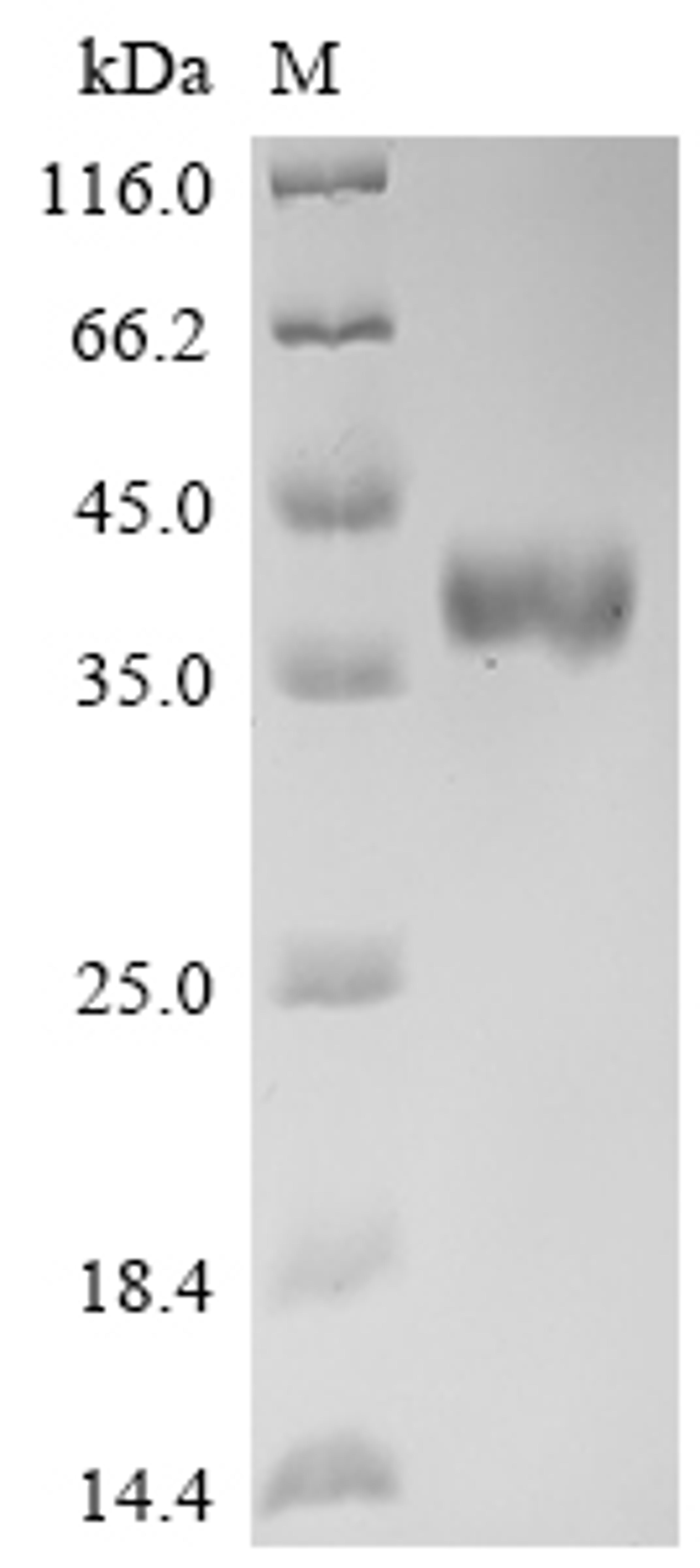 (Tris-Glycine gel) Discontinuous SDS-PAGE (reduced) with 5% enrichment gel and 15% separation gel.