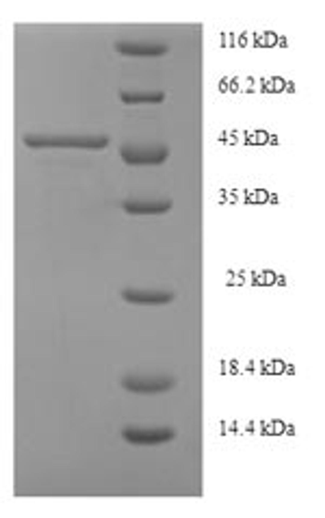 (Tris-Glycine gel) Discontinuous SDS-PAGE (reduced) with 5% enrichment gel and 15% separation gel.
