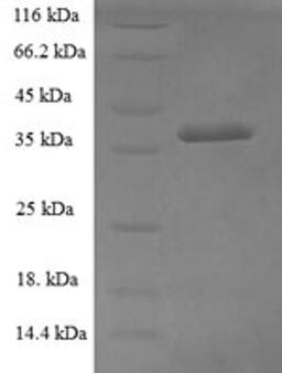 (Tris-Glycine gel) Discontinuous SDS-PAGE (reduced) with 5% enrichment gel and 15% separation gel.