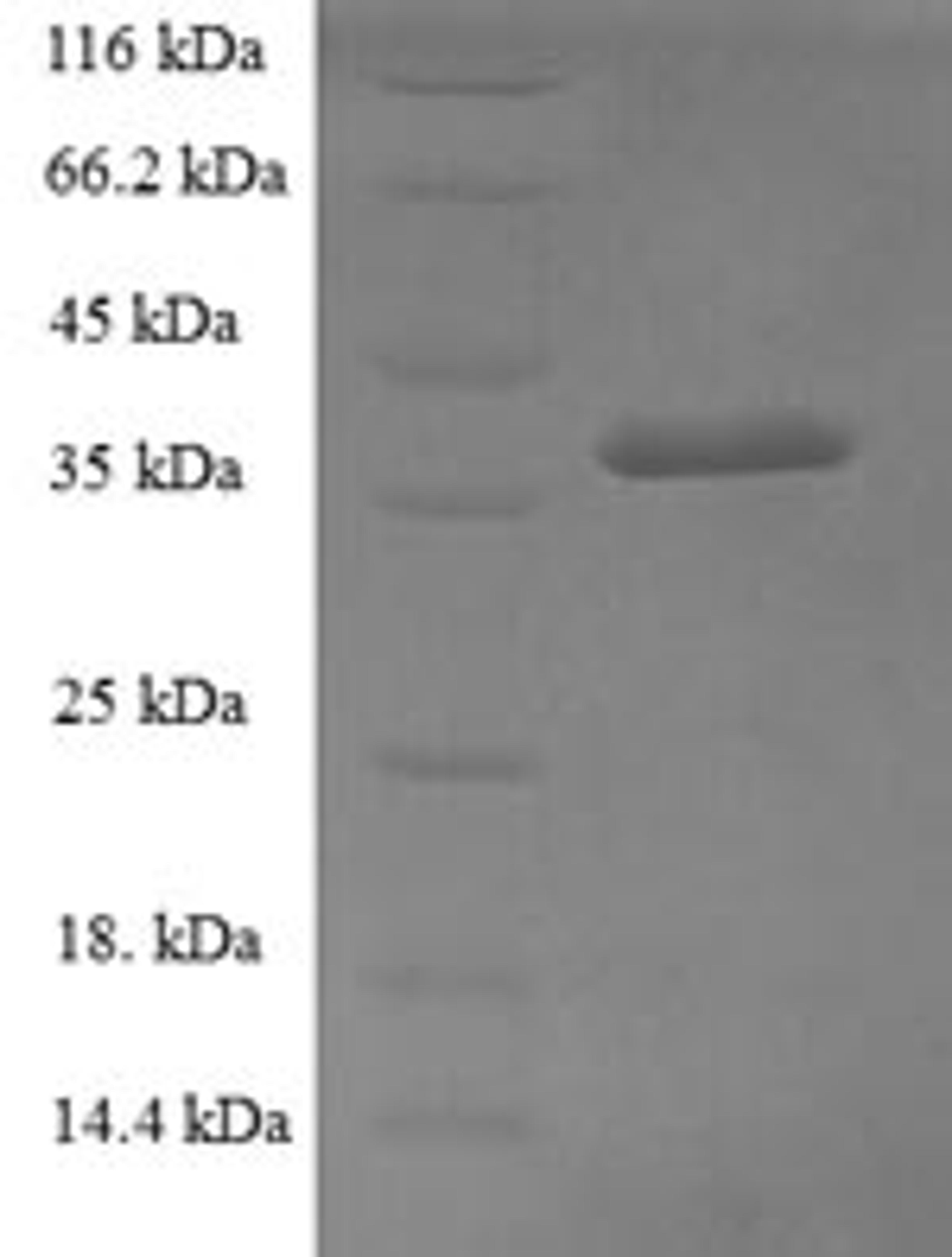 (Tris-Glycine gel) Discontinuous SDS-PAGE (reduced) with 5% enrichment gel and 15% separation gel.