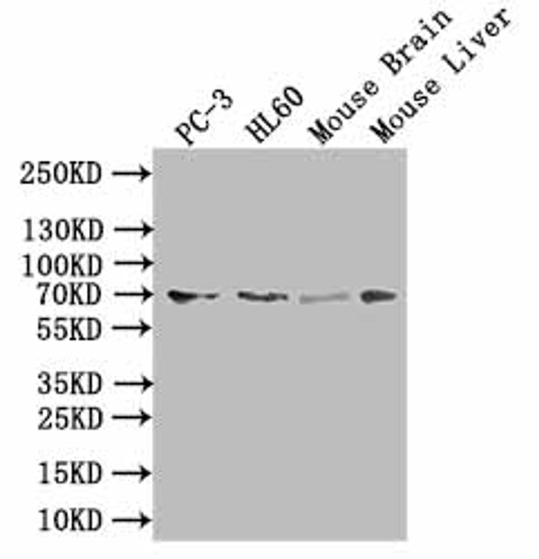 Western blot. All lanes: SLC6A6 antibody at 0.5µg/ml + Human placenta tissue. Secondary. Goat polyclonal to rabbit IgG at 1/10000 dilution. Predicted band size: 70, 23 kDa. Observed band size: 70 kDa