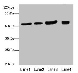 Western blot. All lanes: ANTXR2antibody at 1.24ug/ml. Lane 1: Mouse lung tissue. Lane 2: Mouse gonadal tissue. Lane 3: Mouse kidney tissue. Lane 4: Mouse small intestine tissue. Secondary. Goat polyclonal to rabbit IgG at 1/10000 dilution. Predicted band size: 54, 43, 35 kDa. Observed band size: 54 kDa. 