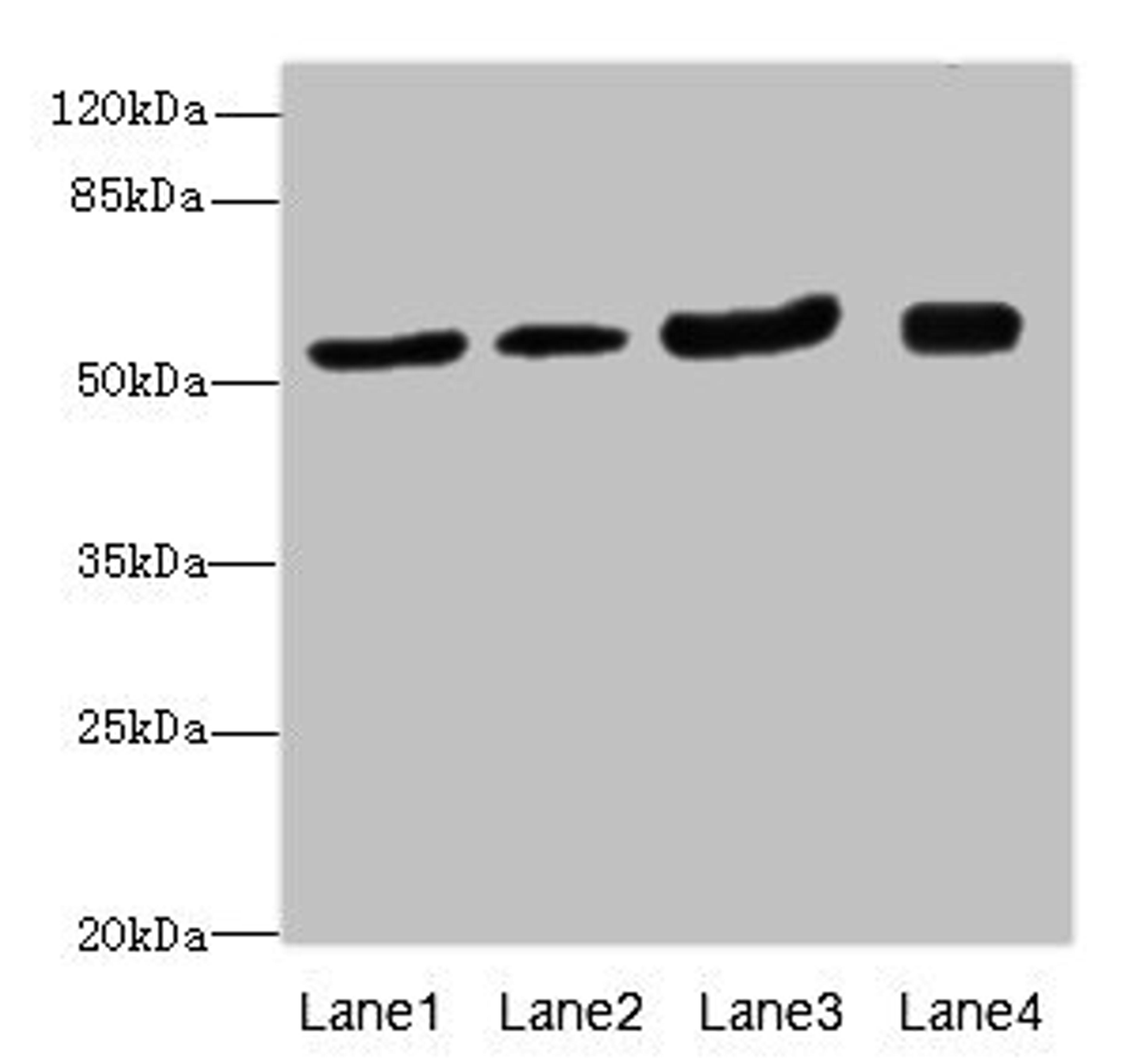 Western blot. All lanes: ANTXR2antibody at 1.24ug/ml. Lane 1: Mouse lung tissue. Lane 2: Mouse gonadal tissue. Lane 3: Mouse kidney tissue. Lane 4: Mouse small intestine tissue. Secondary. Goat polyclonal to rabbit IgG at 1/10000 dilution. Predicted band size: 54, 43, 35 kDa. Observed band size: 54 kDa. 