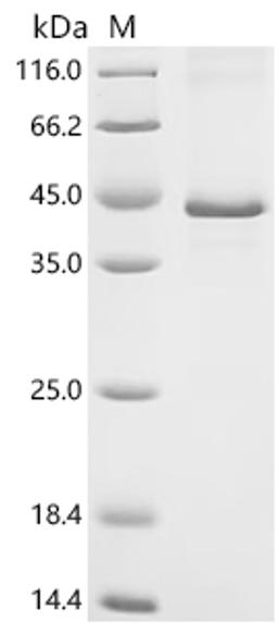 (Tris-Glycine gel) Discontinuous SDS-PAGE (reduced) with 5% enrichment gel and 15% separation gel.