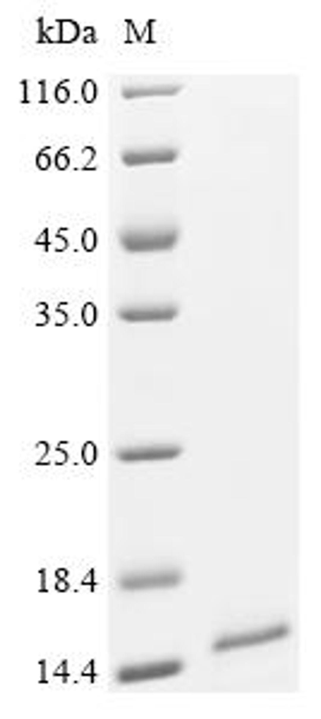 (Tris-Glycine gel) Discontinuous SDS-PAGE (reduced) with 5% enrichment gel and 15% separation gel.
