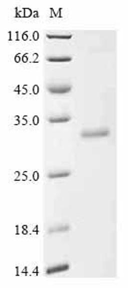 (Tris-Glycine gel) Discontinuous SDS-PAGE (reduced) with 5% enrichment gel and 15% separation gel.