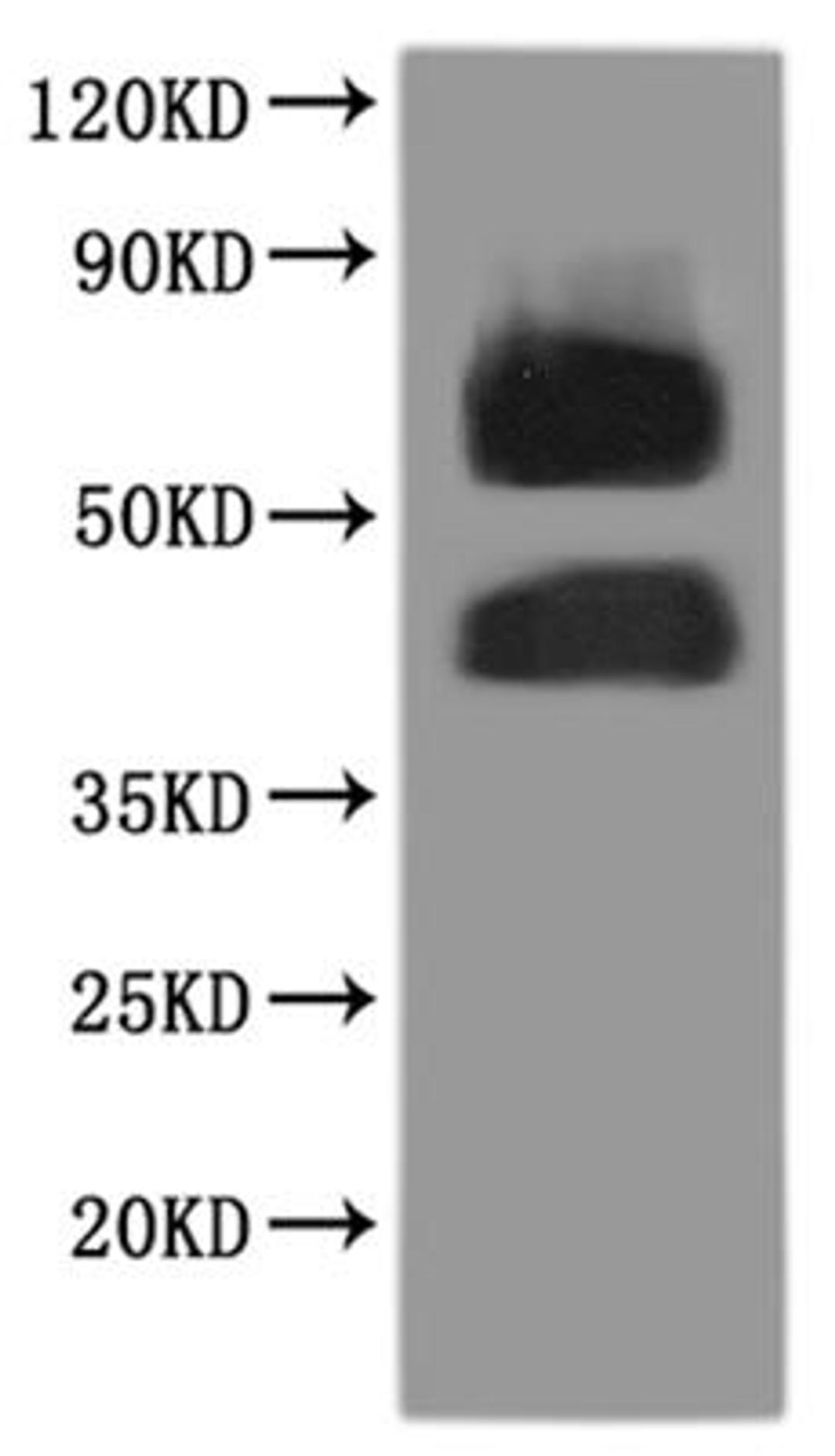CSB-MP008855HU is detected by Mouse anti-6*His monoclonal antibody.