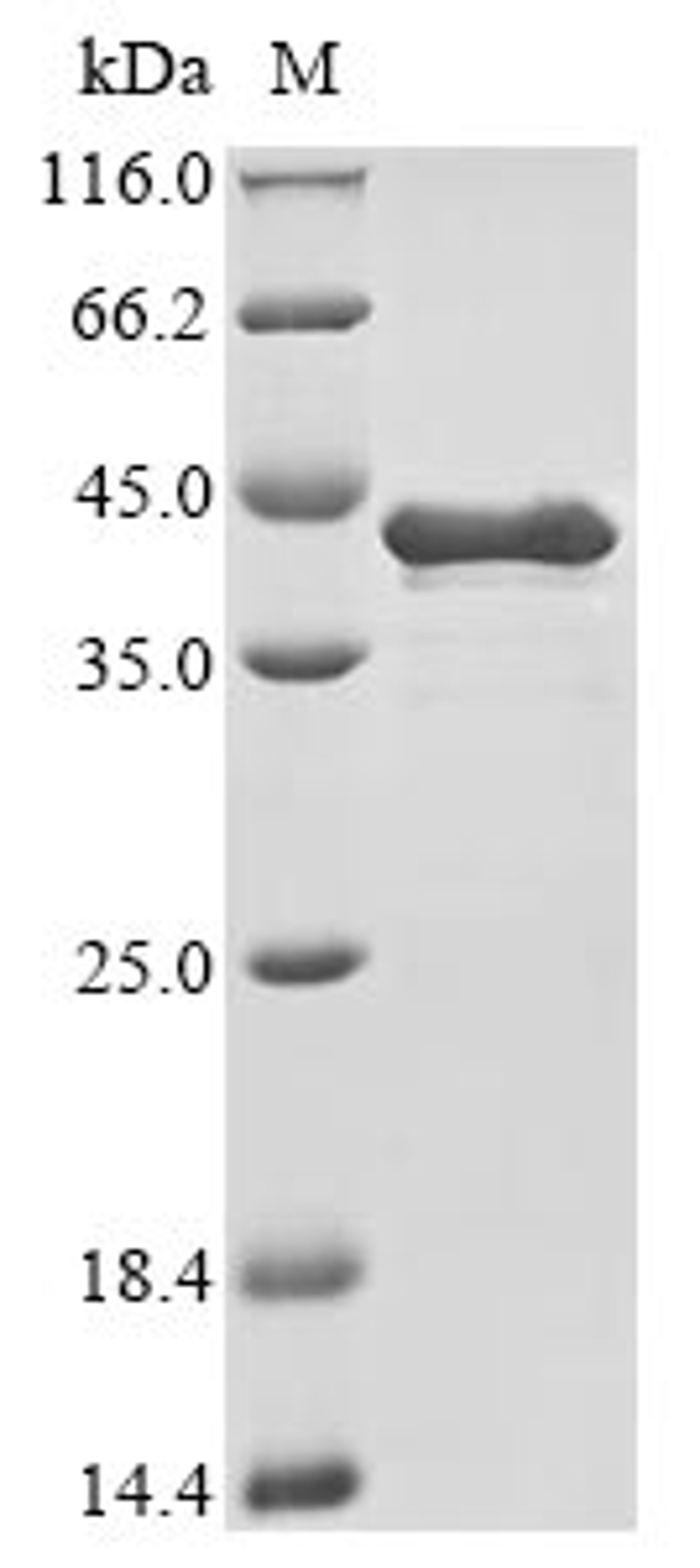 (Tris-Glycine gel) Discontinuous SDS-PAGE (reduced) with 5% enrichment gel and 15% separation gel.