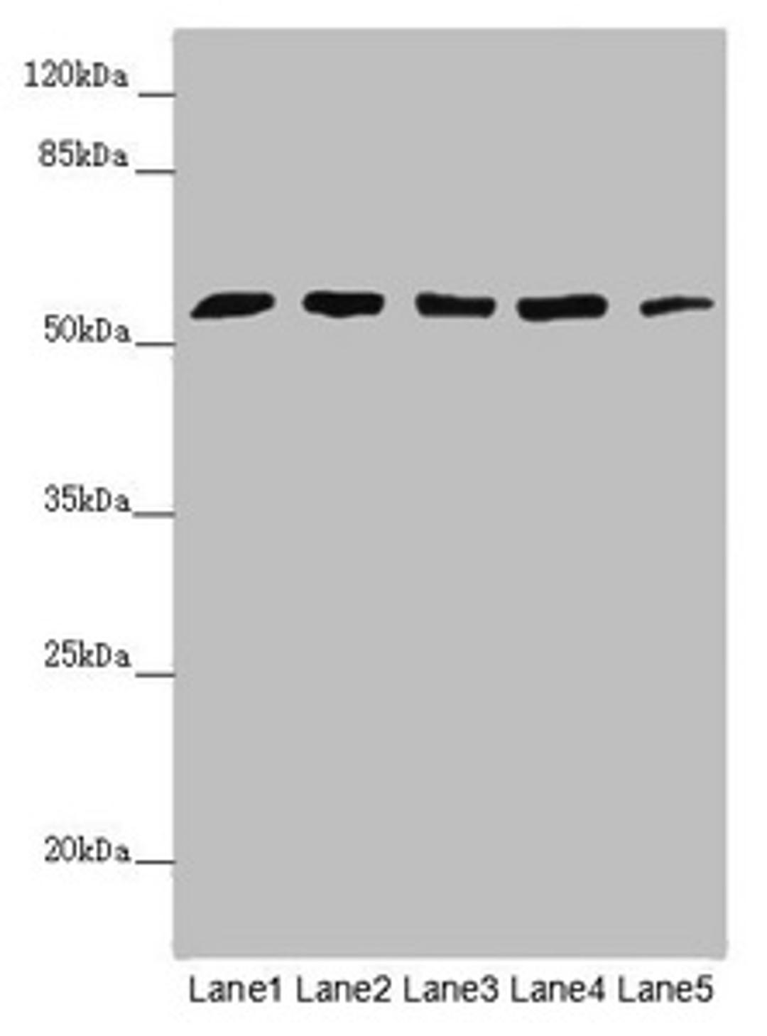 Western blot. All lanes: CEP57L1 antibody at 6.26µg/ml. Lane 1: CEM whole cell lysate. Lane 2: 293T whole cell lysate. Lane 3: Hela whole cell lysate. Lane 4: Jurkat whole cell lysate. Lane 5: A549 whole cell lysate. Secondary. Goat polyclonal to rabbit IgG at 1/10000 dilution. Predicted band size: 54, 46 kDa. Observed band size: 54 kDa