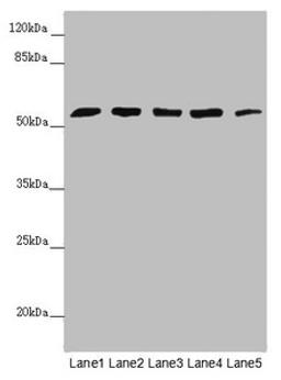 Western blot. All lanes: CEP57L1 antibody at 6.26µg/ml. Lane 1: CEM whole cell lysate. Lane 2: 293T whole cell lysate. Lane 3: Hela whole cell lysate. Lane 4: Jurkat whole cell lysate. Lane 5: A549 whole cell lysate. Secondary. Goat polyclonal to rabbit IgG at 1/10000 dilution. Predicted band size: 54, 46 kDa. Observed band size: 54 kDa