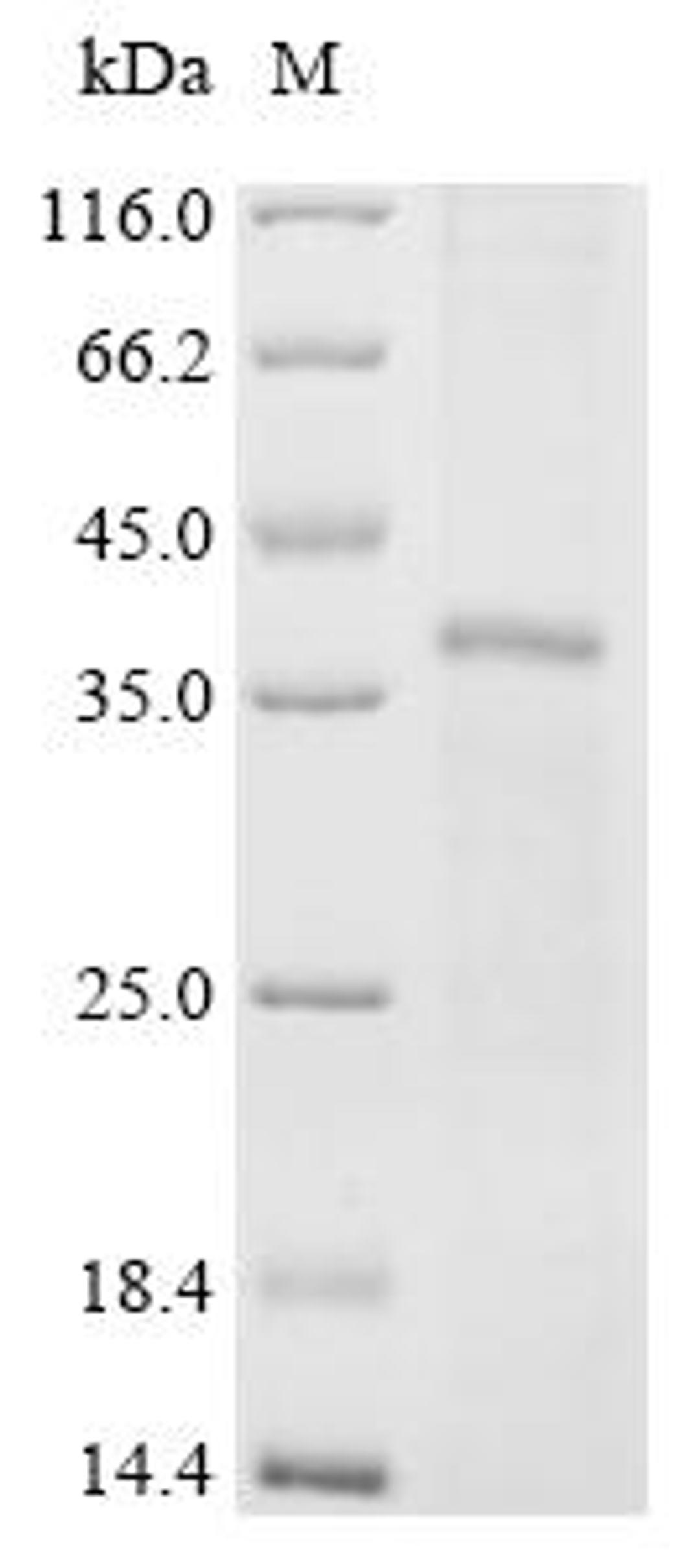 (Tris-Glycine gel) Discontinuous SDS-PAGE (reduced) with 5% enrichment gel and 15% separation gel.