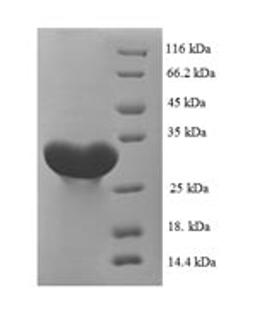 (Tris-Glycine gel) Discontinuous SDS-PAGE (reduced) with 5% enrichment gel and 15% separation gel.