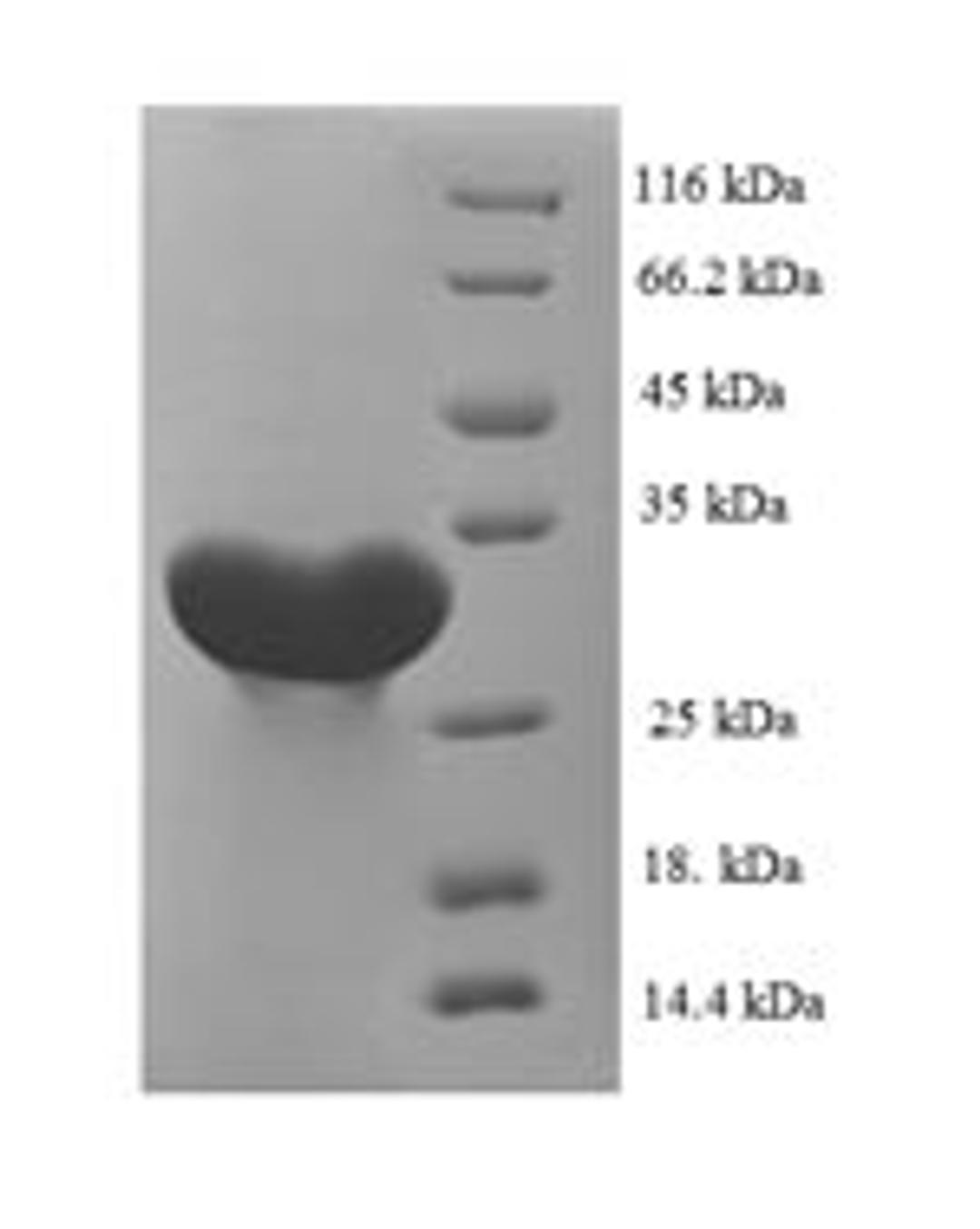 (Tris-Glycine gel) Discontinuous SDS-PAGE (reduced) with 5% enrichment gel and 15% separation gel.