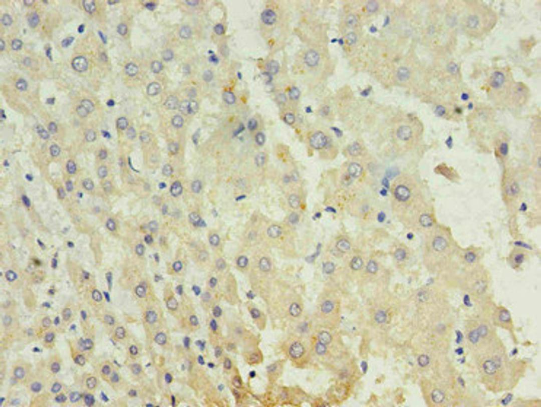 Immunohistochemistry of paraffin-embedded human liver using CSB-MA027711A0m in 30ug/ml dilute concentrations. 
