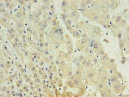 Immunohistochemistry of paraffin-embedded human liver using CSB-MA027711A0m in 30ug/ml dilute concentrations. 