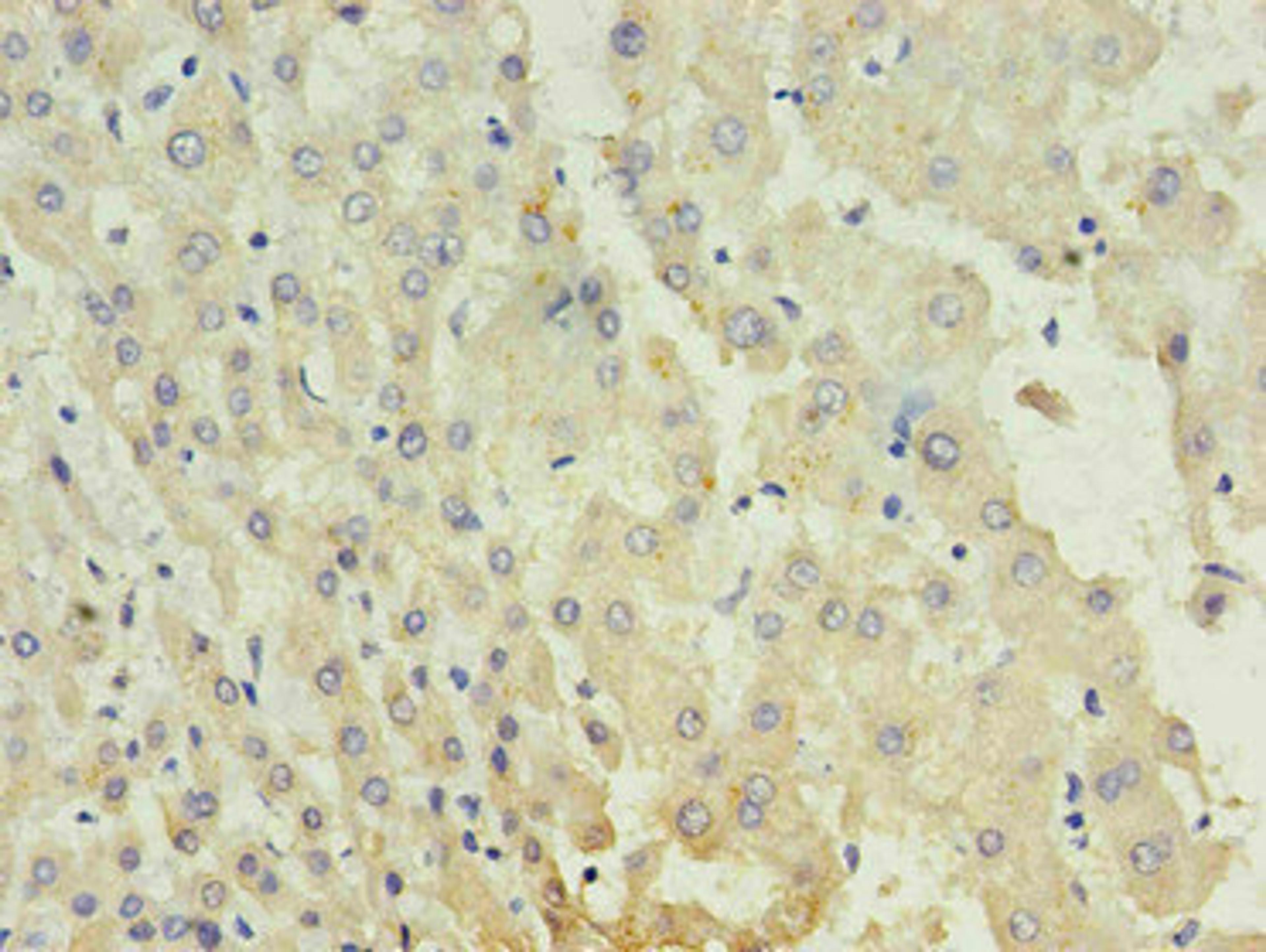 Immunohistochemistry of paraffin-embedded human liver using CSB-MA027711A0m in 30ug/ml dilute concentrations. 
