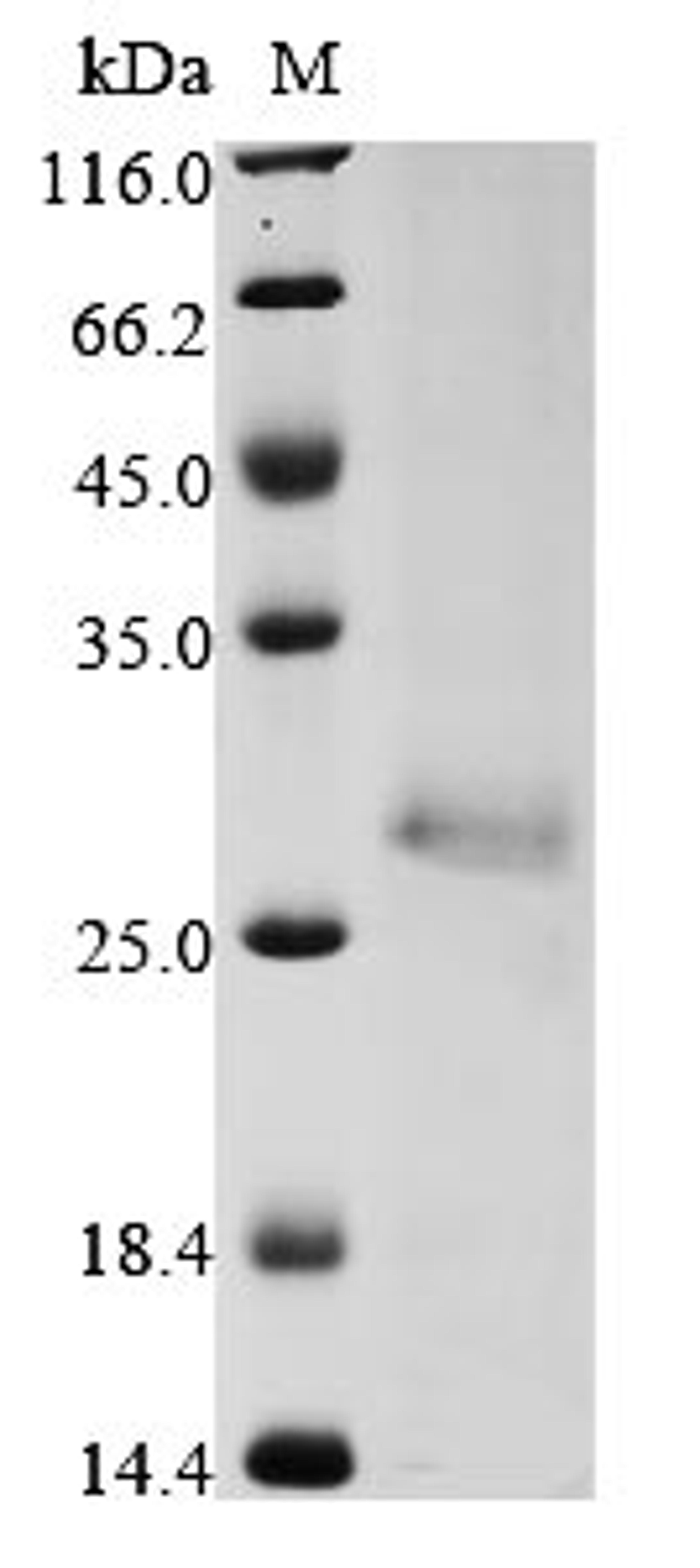 (Tris-Glycine gel) Discontinuous SDS-PAGE (reduced) with 5% enrichment gel and 15% separation gel.