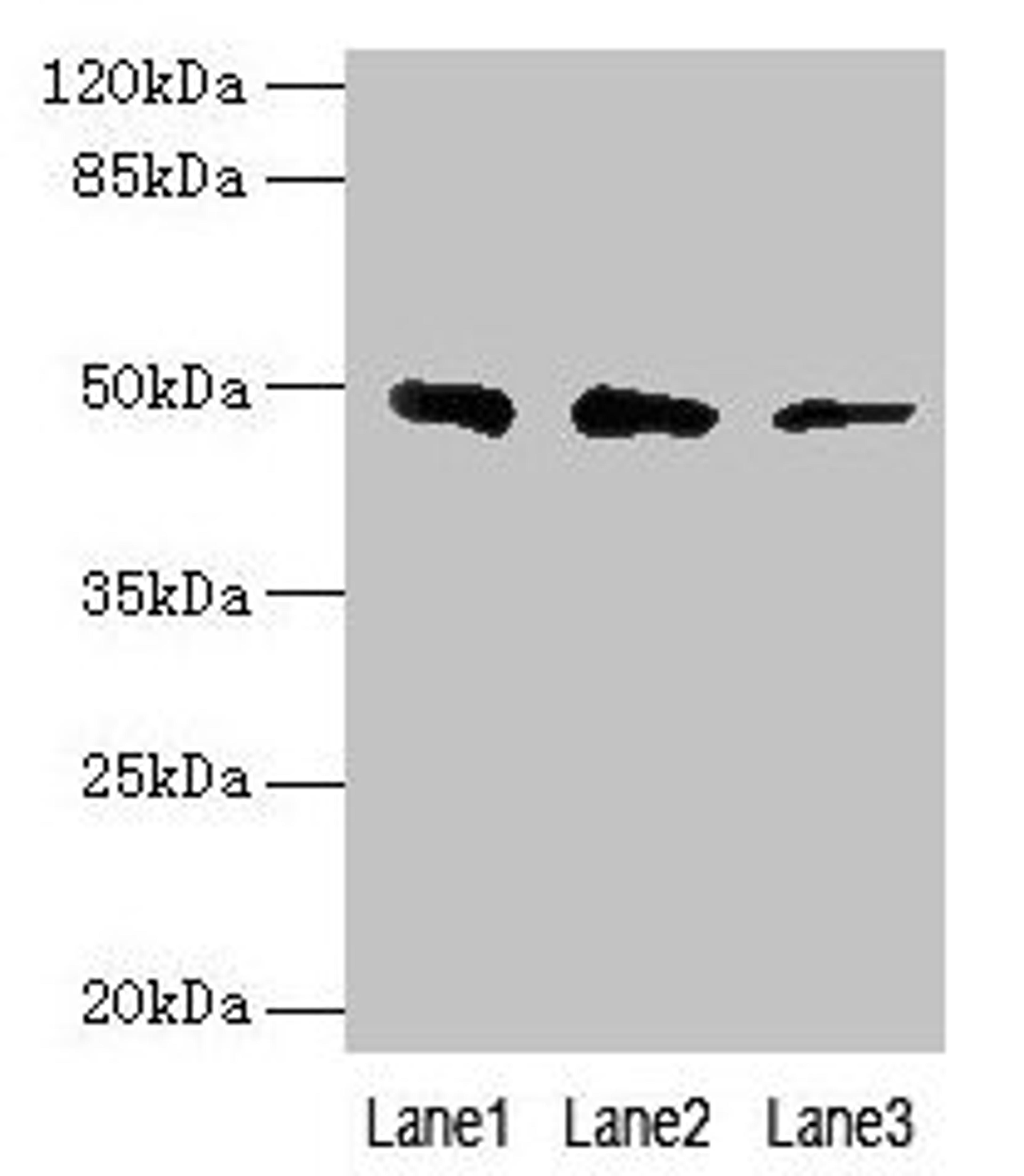 Western blot. All lanes: ZBTB6 antibody at 8µg/ml. Lane 1: Hela whole cell lysate. Lane 2: HepG2 whole cell lysate. Lane 3: 293T whole cell lysate. Secondary. Goat polyclonal to rabbit IgG at 1/10000 dilution. Predicted band size: 49 kDa. Observed band size: 49 kDa