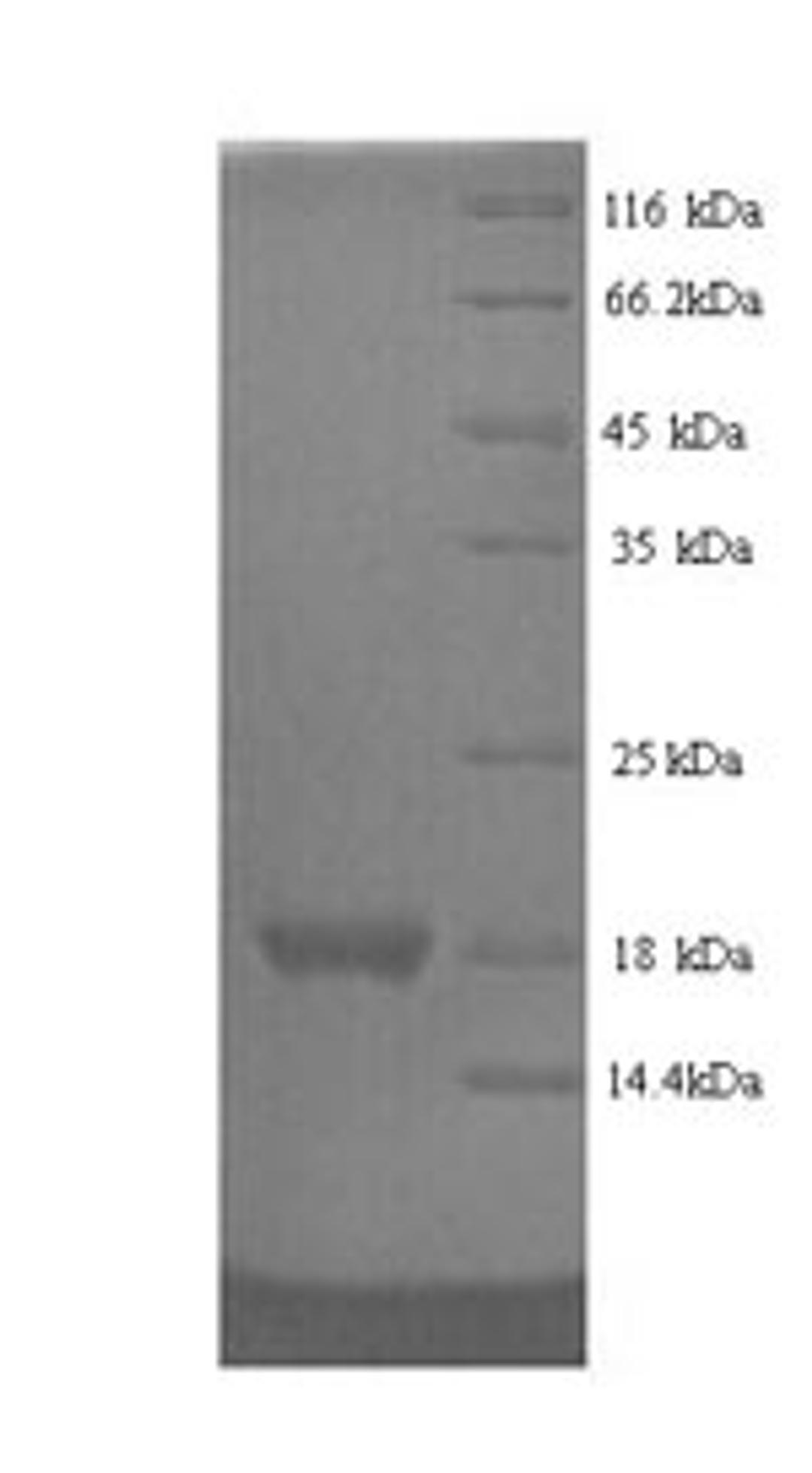 (Tris-Glycine gel) Discontinuous SDS-PAGE (reduced) with 5% enrichment gel and 15% separation gel.