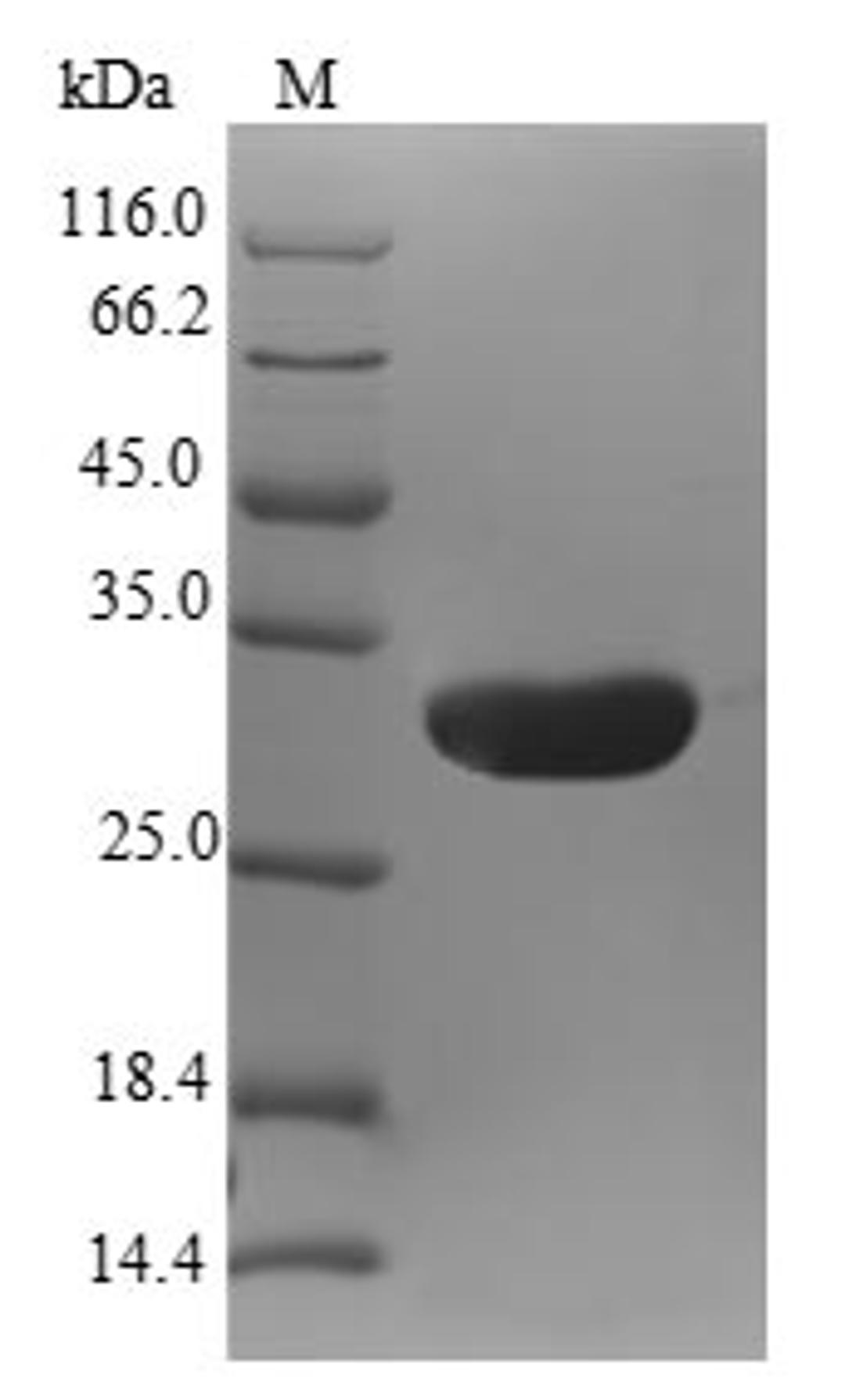 (Tris-Glycine gel) Discontinuous SDS-PAGE (reduced) with 5% enrichment gel and 15% separation gel.
