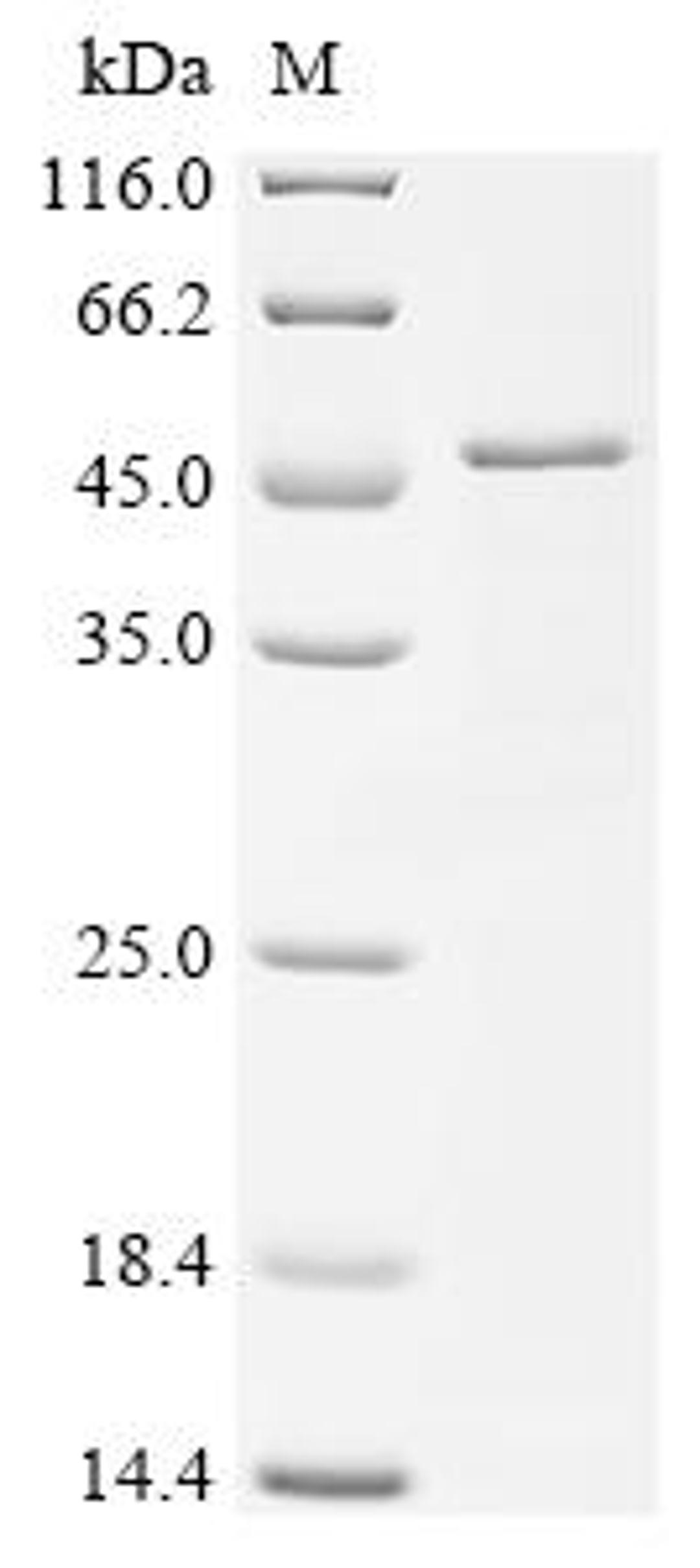 (Tris-Glycine gel) Discontinuous SDS-PAGE (reduced) with 5% enrichment gel and 15% separation gel.