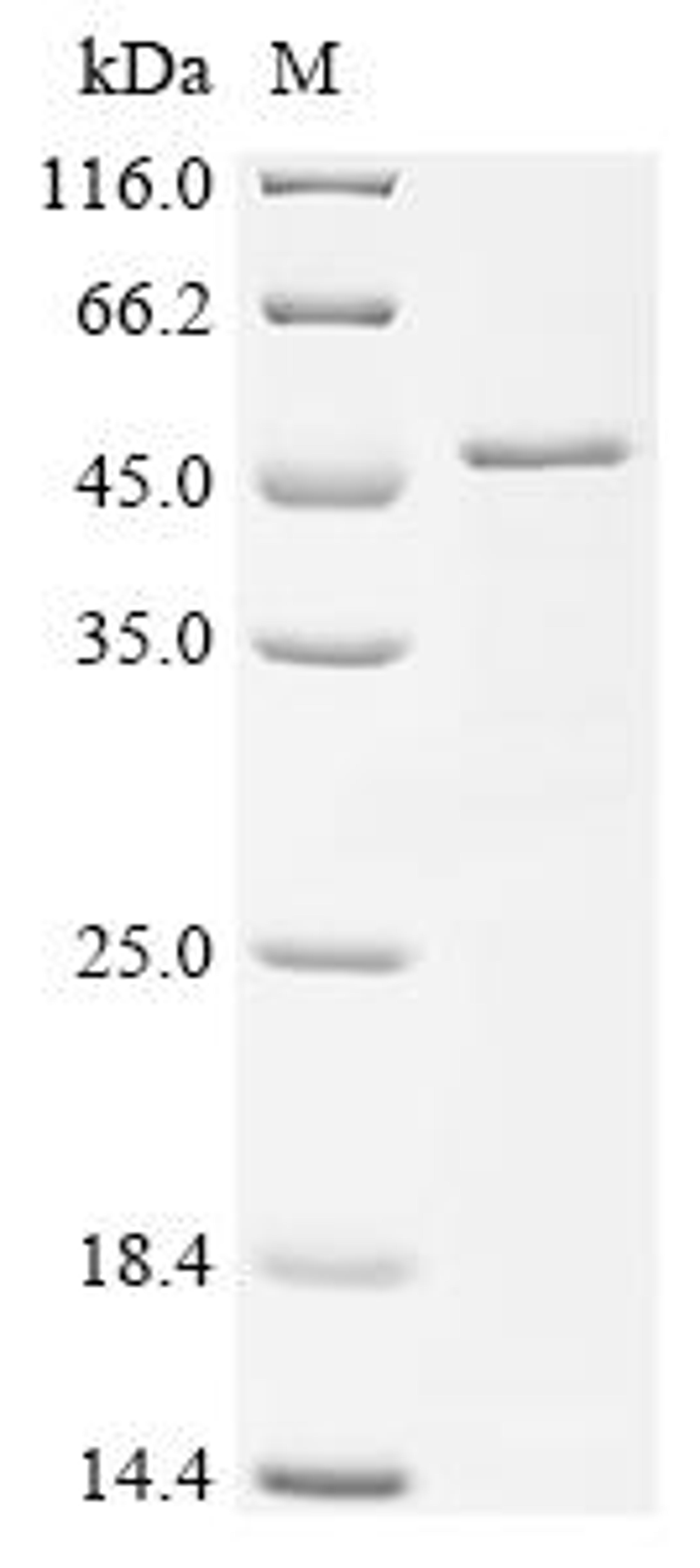 (Tris-Glycine gel) Discontinuous SDS-PAGE (reduced) with 5% enrichment gel and 15% separation gel.