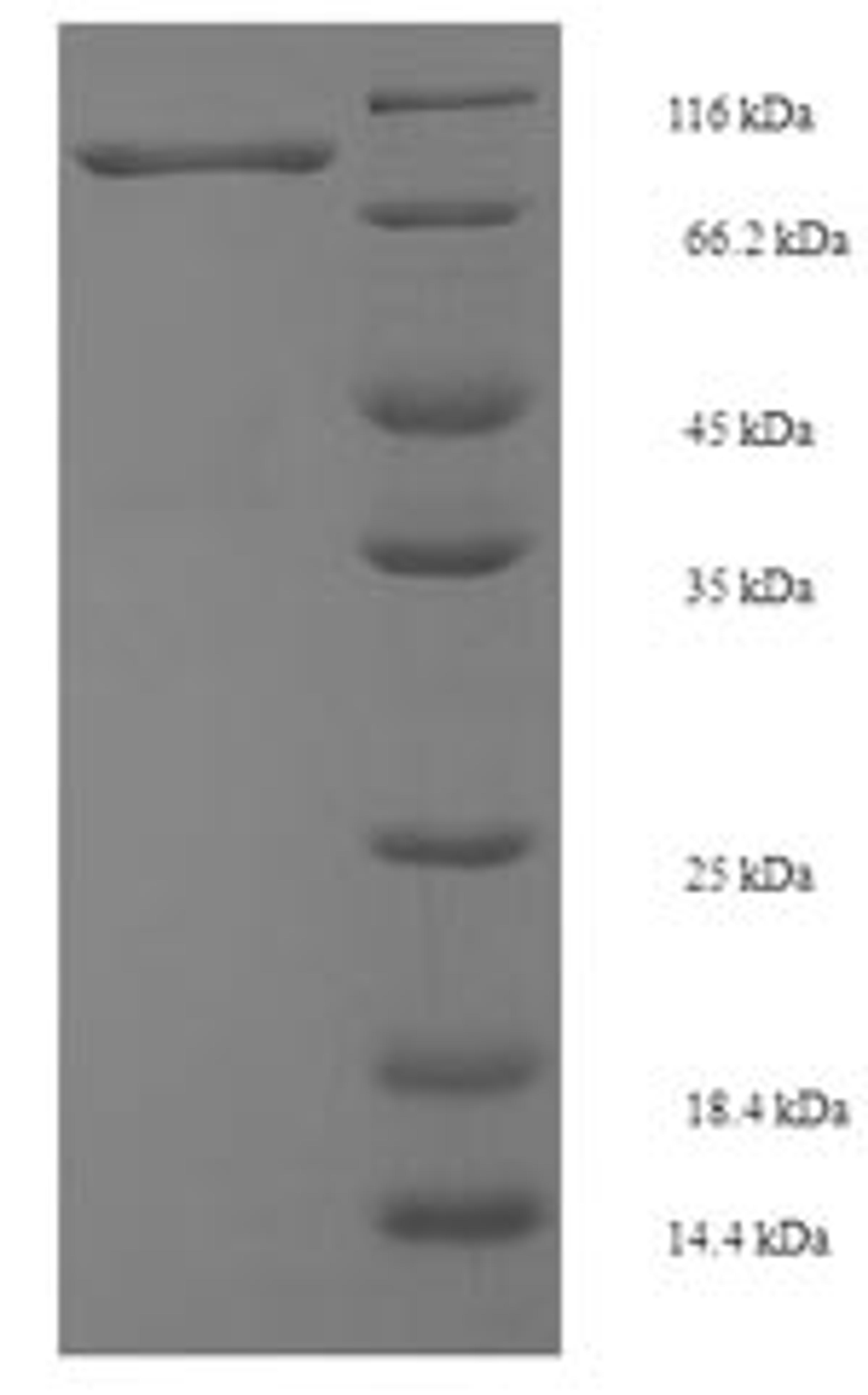(Tris-Glycine gel) Discontinuous SDS-PAGE (reduced) with 5% enrichment gel and 15% separation gel.