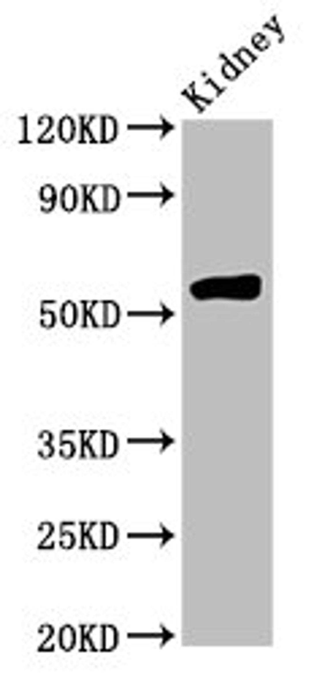 Western Blot. Positive WB detected in: Rat kidney tissue. All lanes: HMGCS2 antibody at 4.5ug/ml. Secondary. Goat polyclonal to rabbit IgG at 1/50000 dilution. Predicted band size: 57, 53, 51 kDa. Observed band size: 57 kDa.