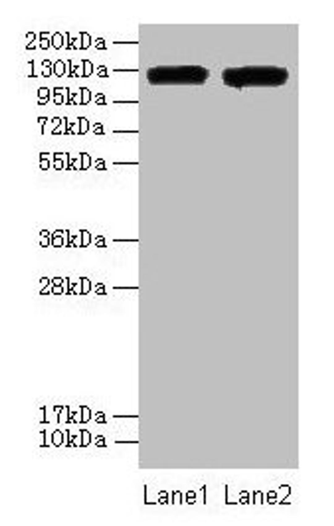 Western blot. All lanes: ITGAL antibody at 8µg/ml. Lane 1: A549 whole cell lysate. Lane 2: HepG2 whole cell lysate. Secondary. Goat polyclonal to rabbit IgG at 1/10000 dilution. Predicted band size: 129, 135, 120 kDa. Observed band size: 129 kDa