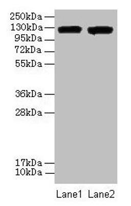 Western blot. All lanes: ITGAL antibody at 8µg/ml. Lane 1: A549 whole cell lysate. Lane 2: HepG2 whole cell lysate. Secondary. Goat polyclonal to rabbit IgG at 1/10000 dilution. Predicted band size: 129, 135, 120 kDa. Observed band size: 129 kDa