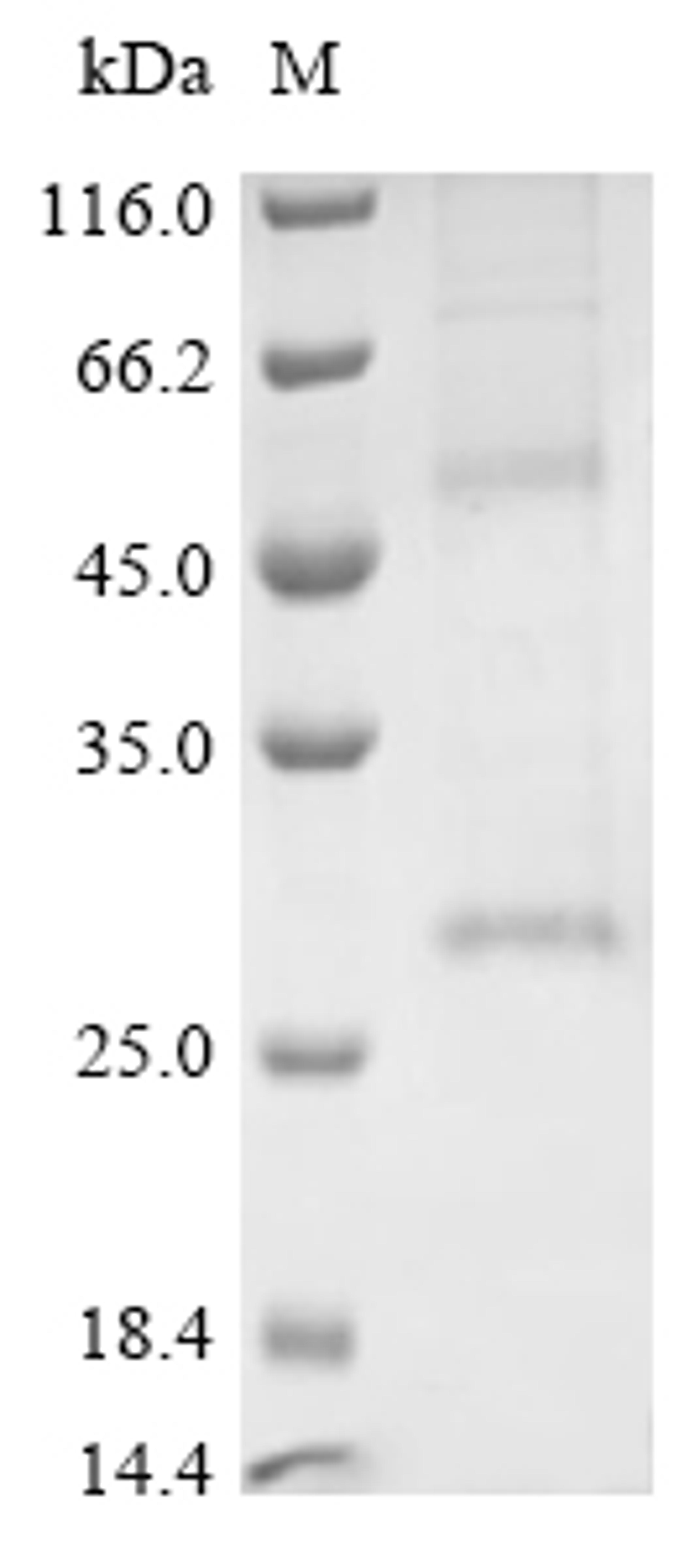(Tris-Glycine gel) Discontinuous SDS-PAGE (reduced) with 5% enrichment gel and 15% separation gel.