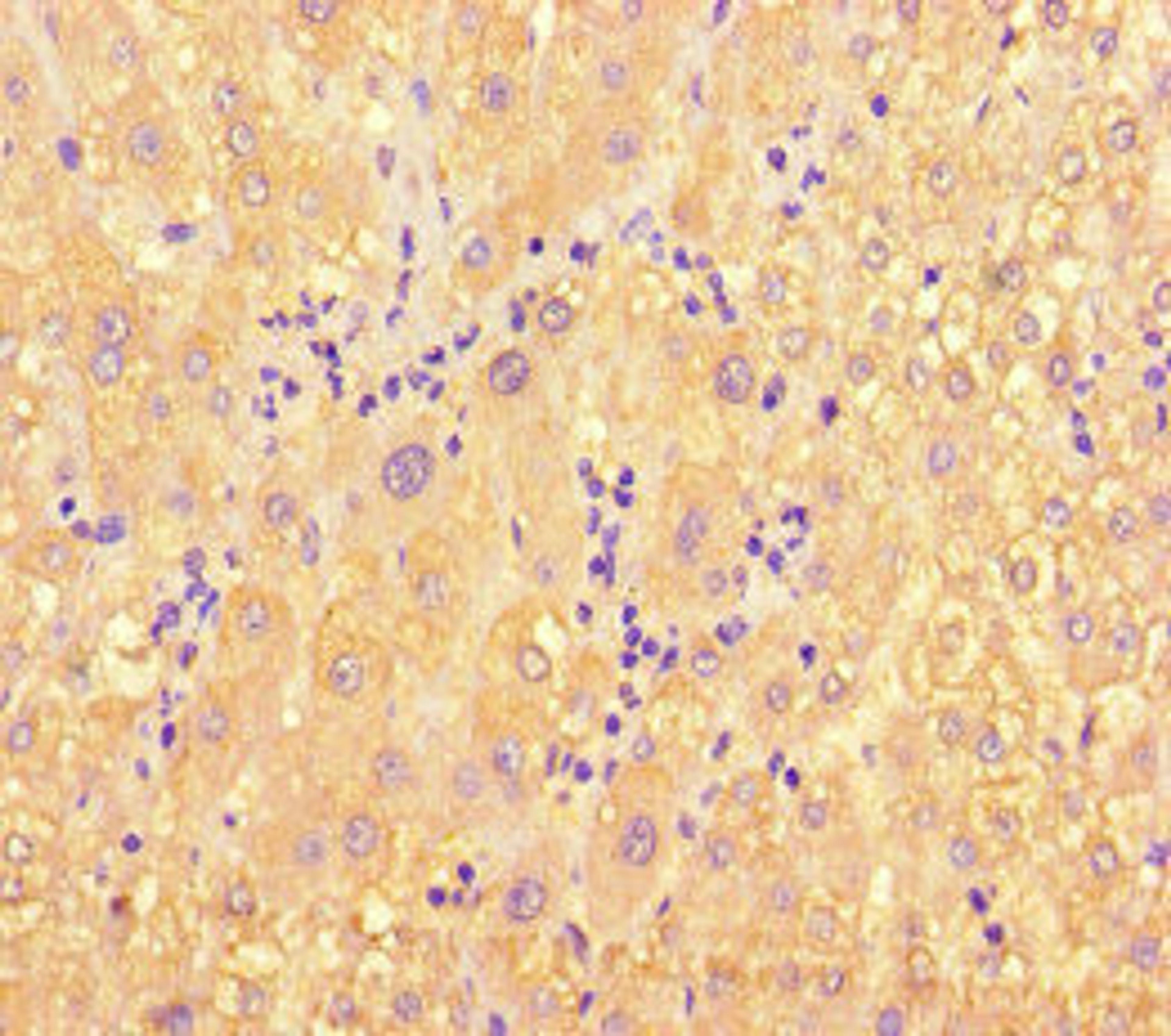 Immunohistochemistry of paraffin-embedded human liver tissue using CSB-PA013632LA01HU at dilution of 1:100