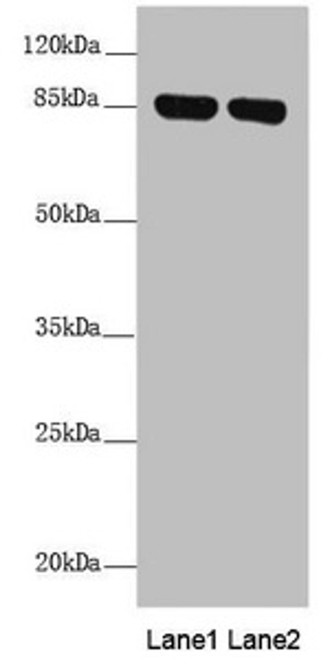 Western blot. All lanes: NDUFS1 antibody at 2.41 ug/ml. Lane 1: Mouse heart tissue. Lane 2: Mouse kidney tissue. Secondary. Goat polyclonal to rabbit IgG at 1/10000 dilution. Predicted band size: 80, 81, 68, 74, 76 kDa. Observed band size: 80 kDa. 