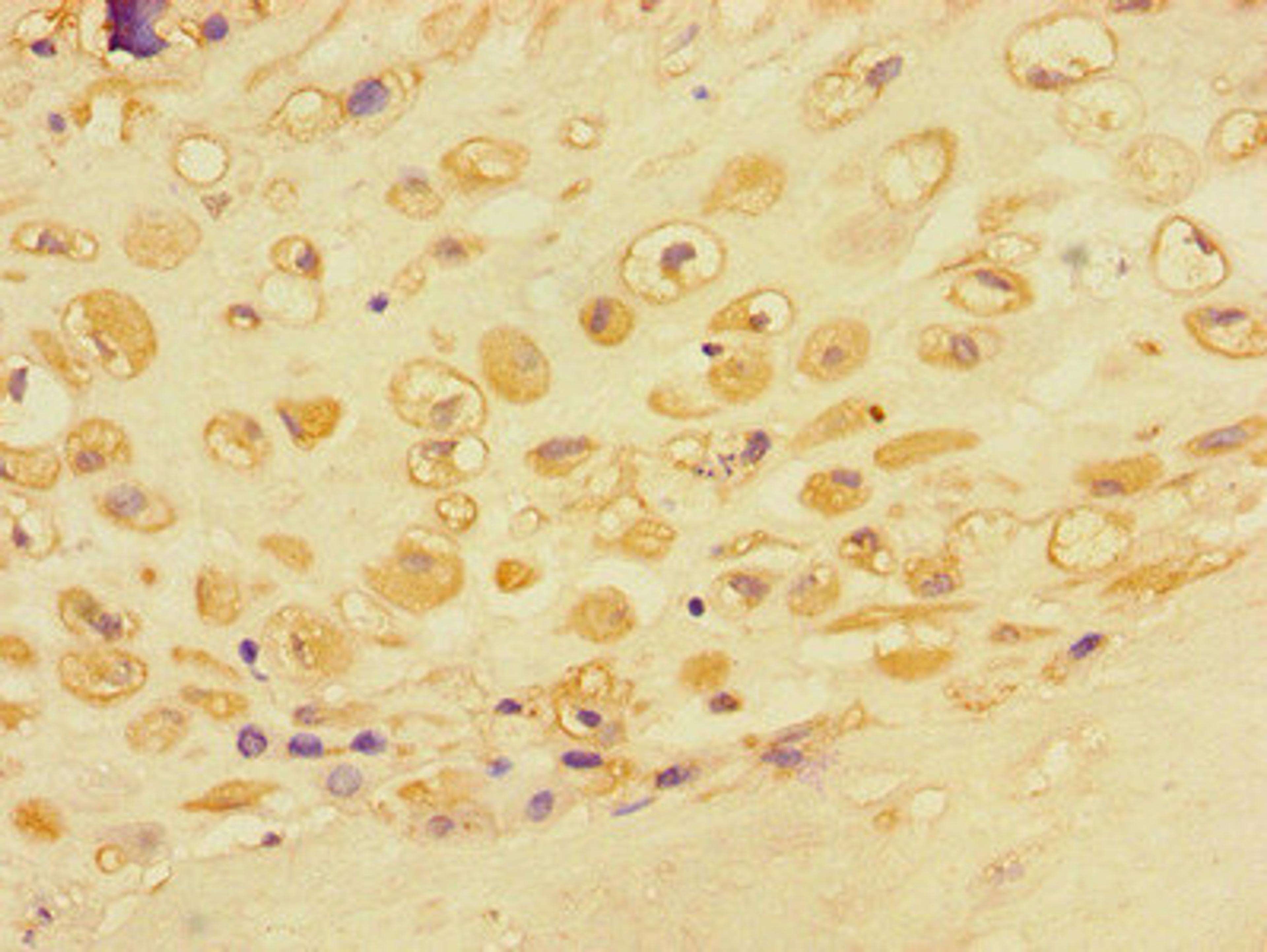 Immunohistochemistry of paraffin-embedded human placental tissue using CSB-PA878955LA01HU at dilution of 1:100