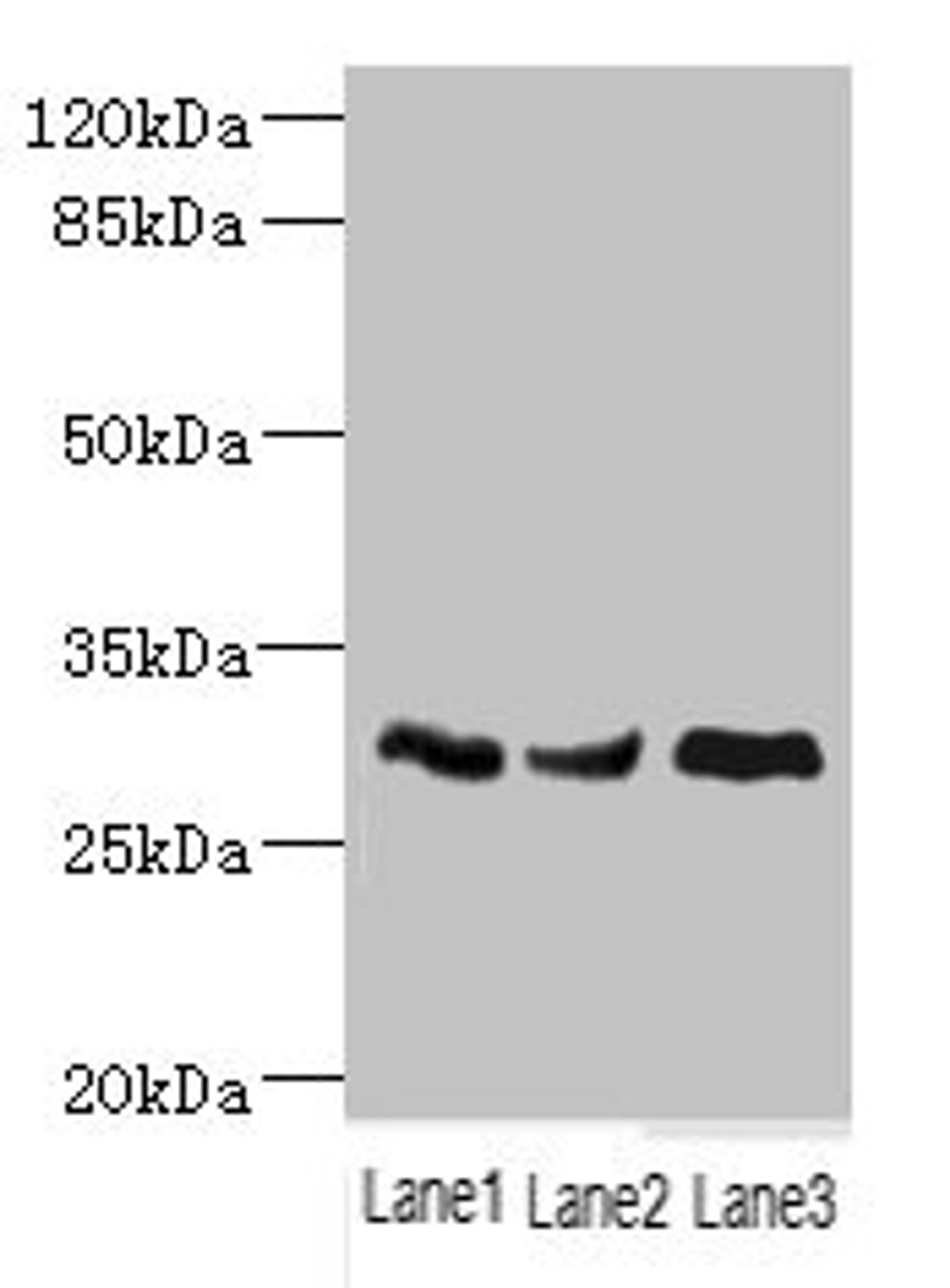 Western blot. All lanes: NDUFS3 antibody at 1.98ug/ml. Lane 1: Mouse brain tissue. Lane 2: Mouse skeletal muscle tissue. Lane 3: Mouse heart tissue. Secondary. Goat polyclonal to rabbit IgG at 1/10000 dilution. Predicted band size: 31, 15 kDa. Observed band size: 31 kDa. 
