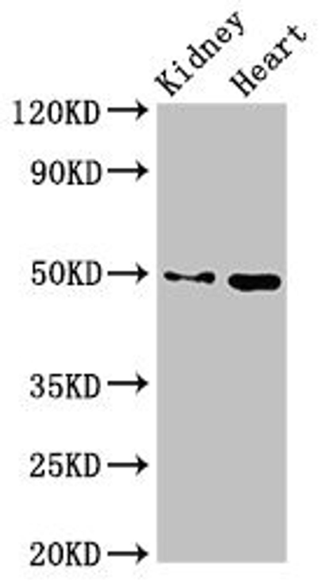 Western Blot. Positive WB detected in: Mouse kidney tissue, Mouse heart tissue. All lanes: MYC antibody at 2.7ug/ml. Secondary. Goat polyclonal to rabbit IgG at 1/50000 dilution. Predicted band size: 49 kDa. Observed band size: 49 kDa. 