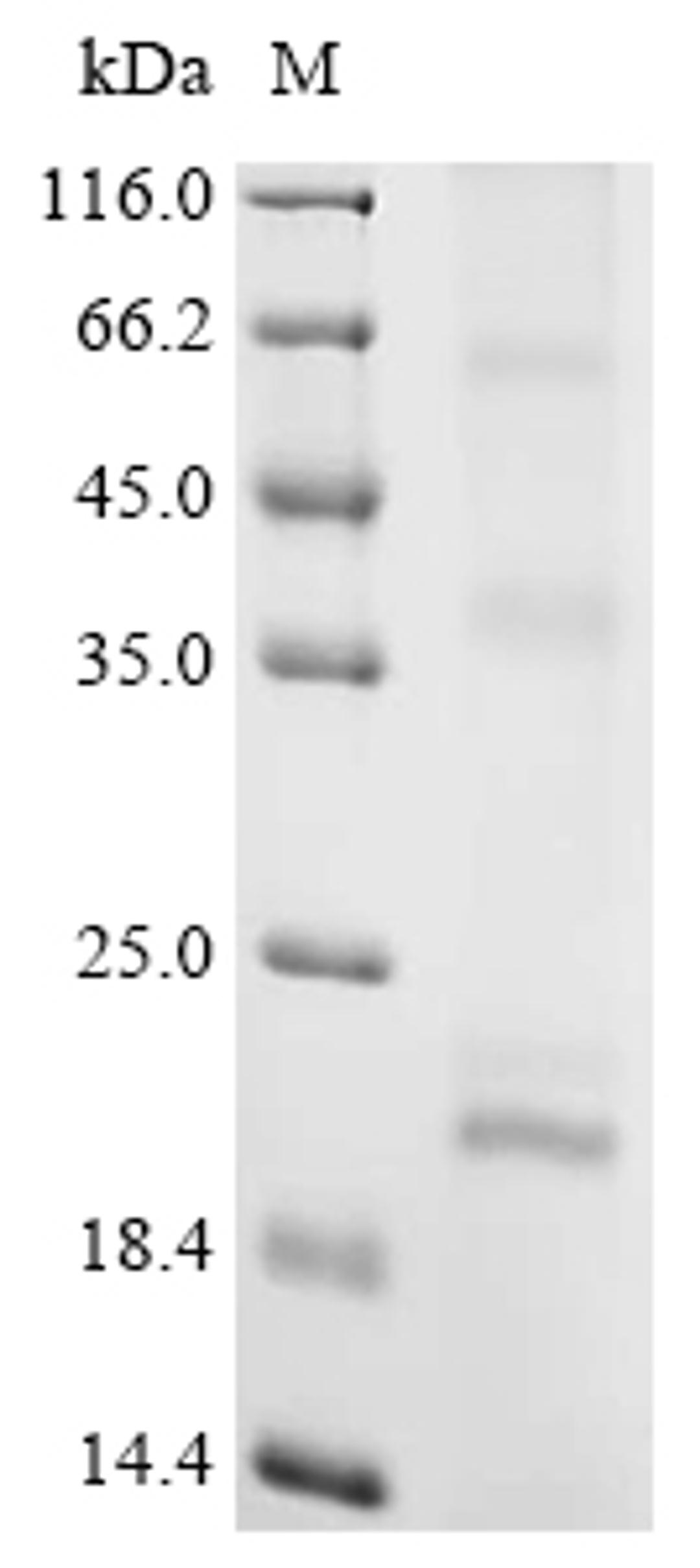 (Tris-Glycine gel) Discontinuous SDS-PAGE (reduced) with 5% enrichment gel and 15% separation gel.