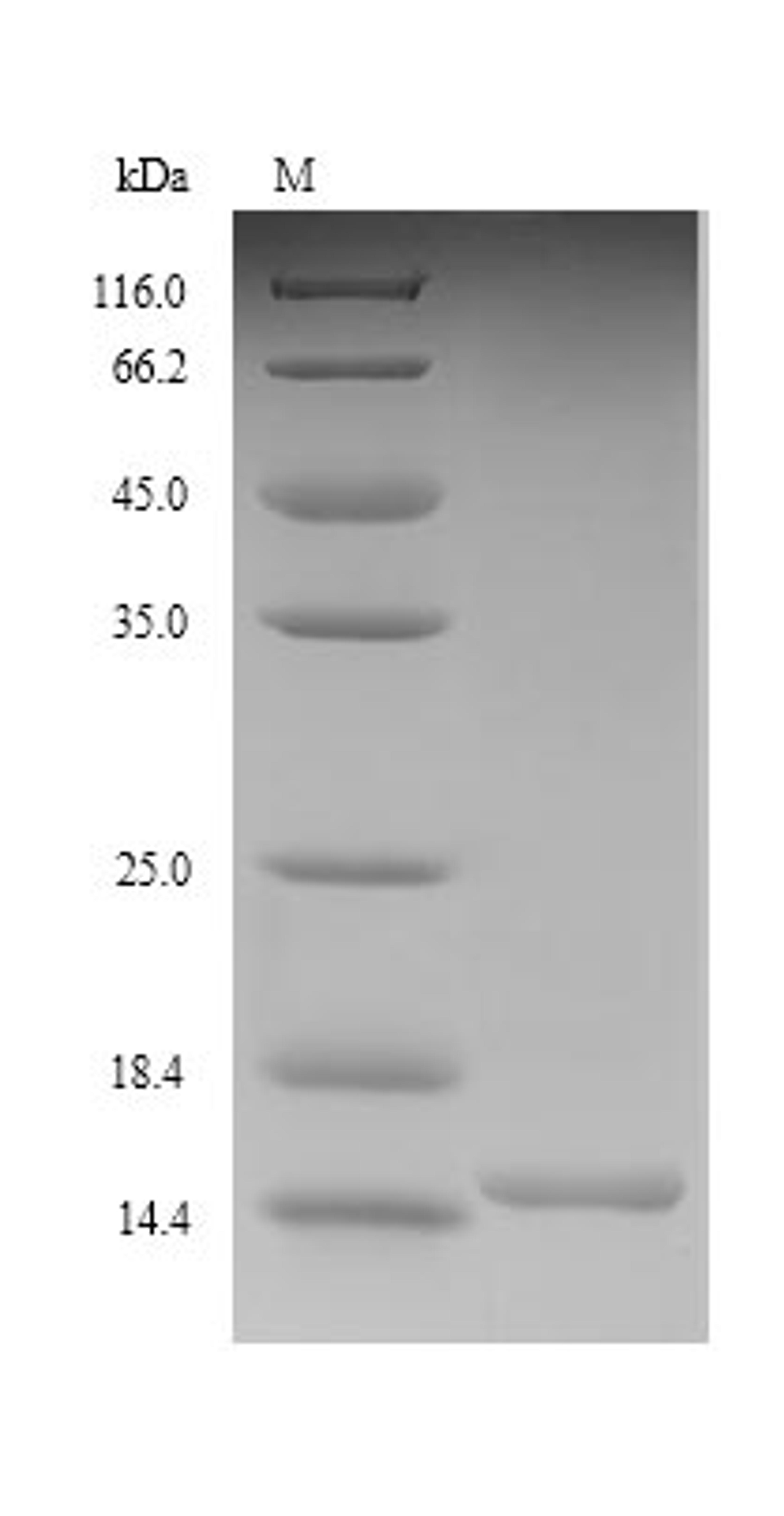 (Tris-Glycine gel) Discontinuous SDS-PAGE (reduced) with 5% enrichment gel and 15% separation gel.