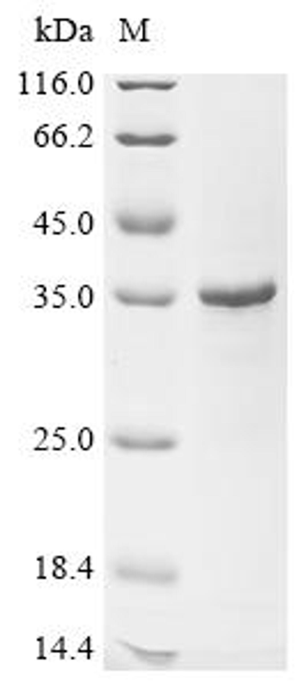 (Tris-Glycine gel) Discontinuous SDS-PAGE (reduced) with 5% enrichment gel and 15% separation gel.