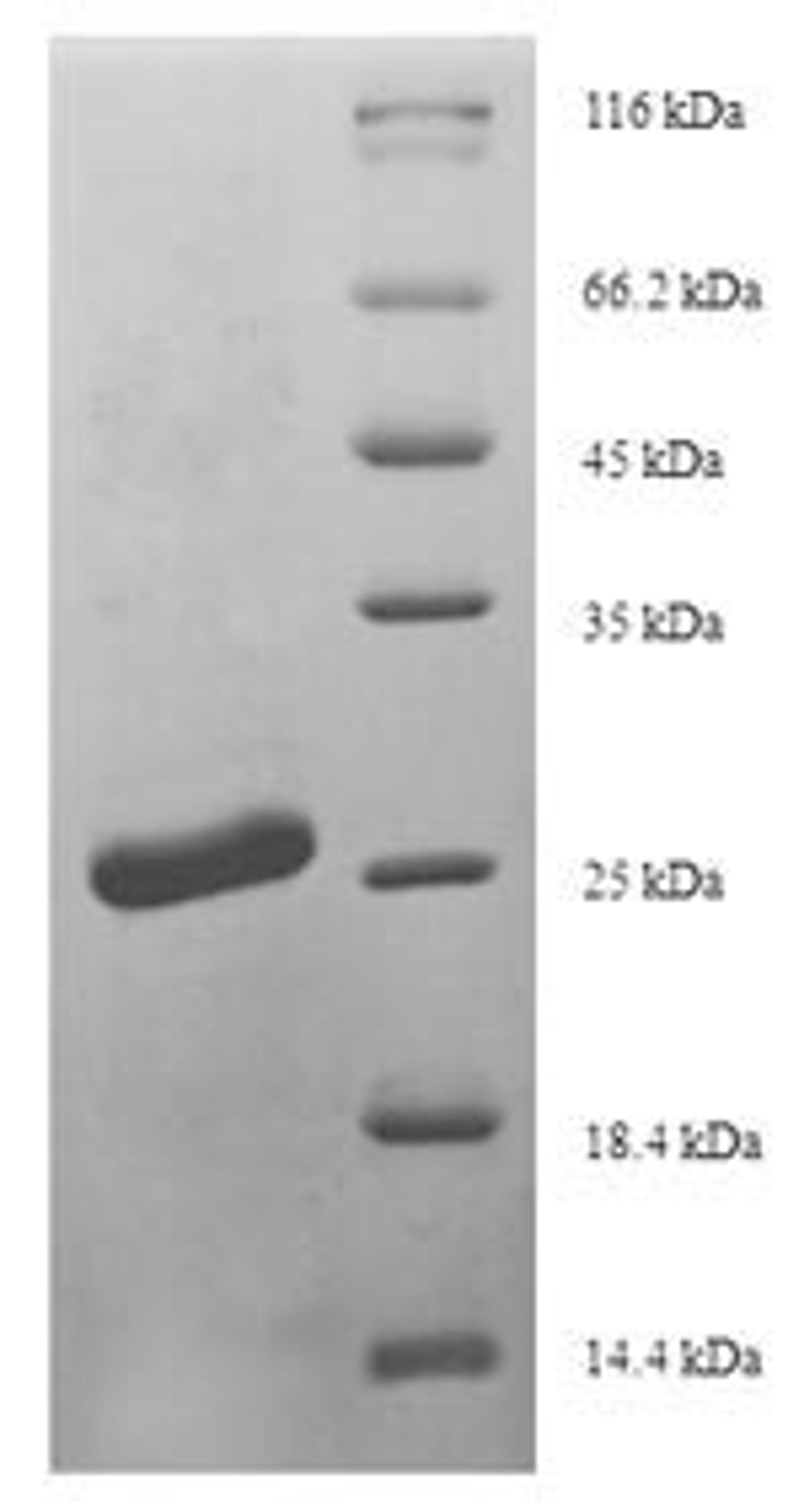 (Tris-Glycine gel) Discontinuous SDS-PAGE (reduced) with 5% enrichment gel and 15% separation gel.