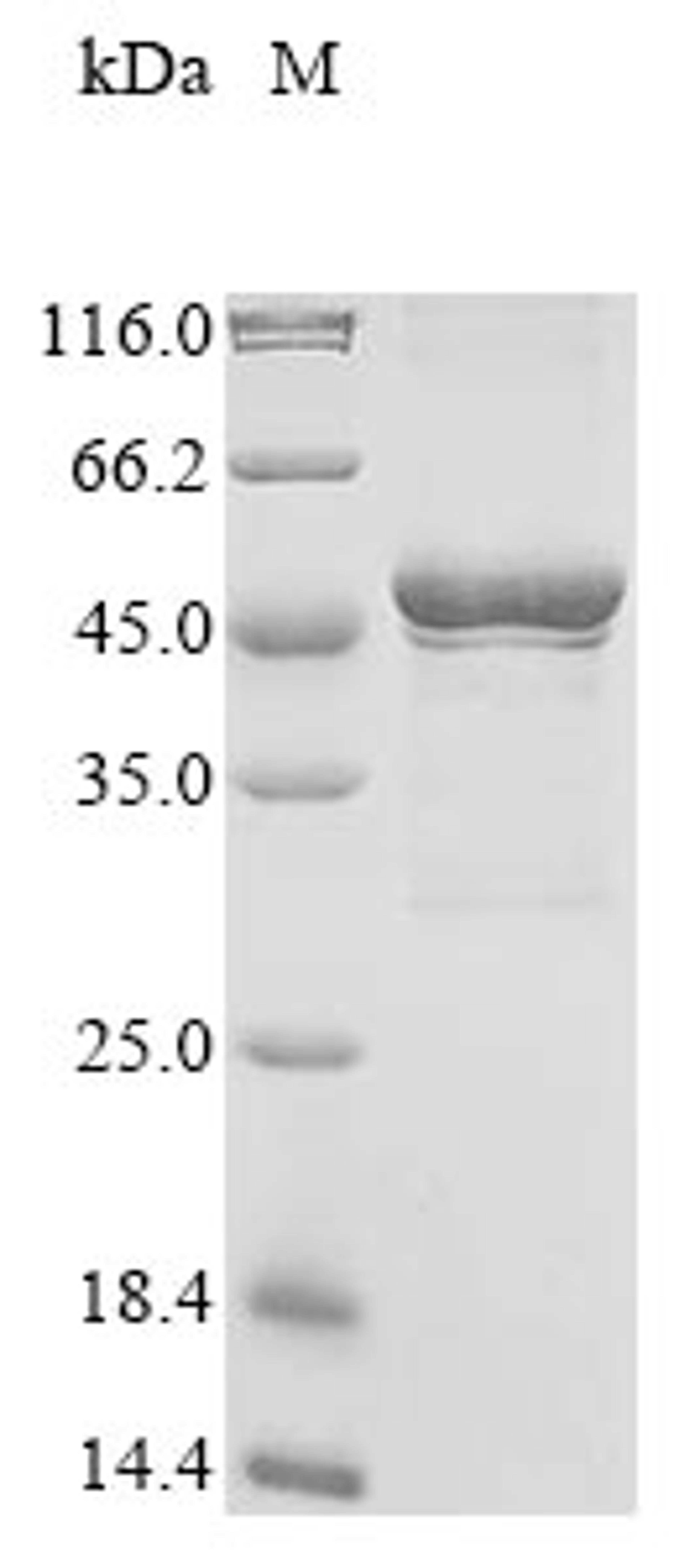 (Tris-Glycine gel) Discontinuous SDS-PAGE (reduced) with 5% enrichment gel and 15% separation gel.