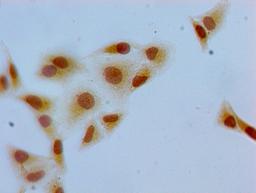 Immunocytochemistry analysis of Hela cells using CSB-PA010100PA07me1HU at dilution of 1:100