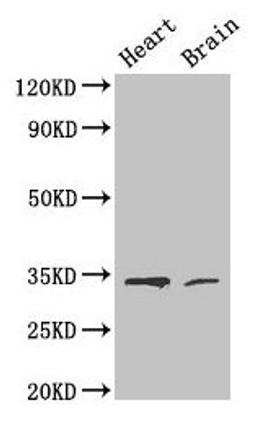 Western Blot. Positive WB detected in: Mouse heart tissue, Mouse brain tissue. All lanes: CDK5 antibody at 4µg/ml. Secondary. Goat polyclonal to rabbit IgG at 1/50000 dilution. Predicted band size: 34, 30 kDa. Observed band size: 34 kDa