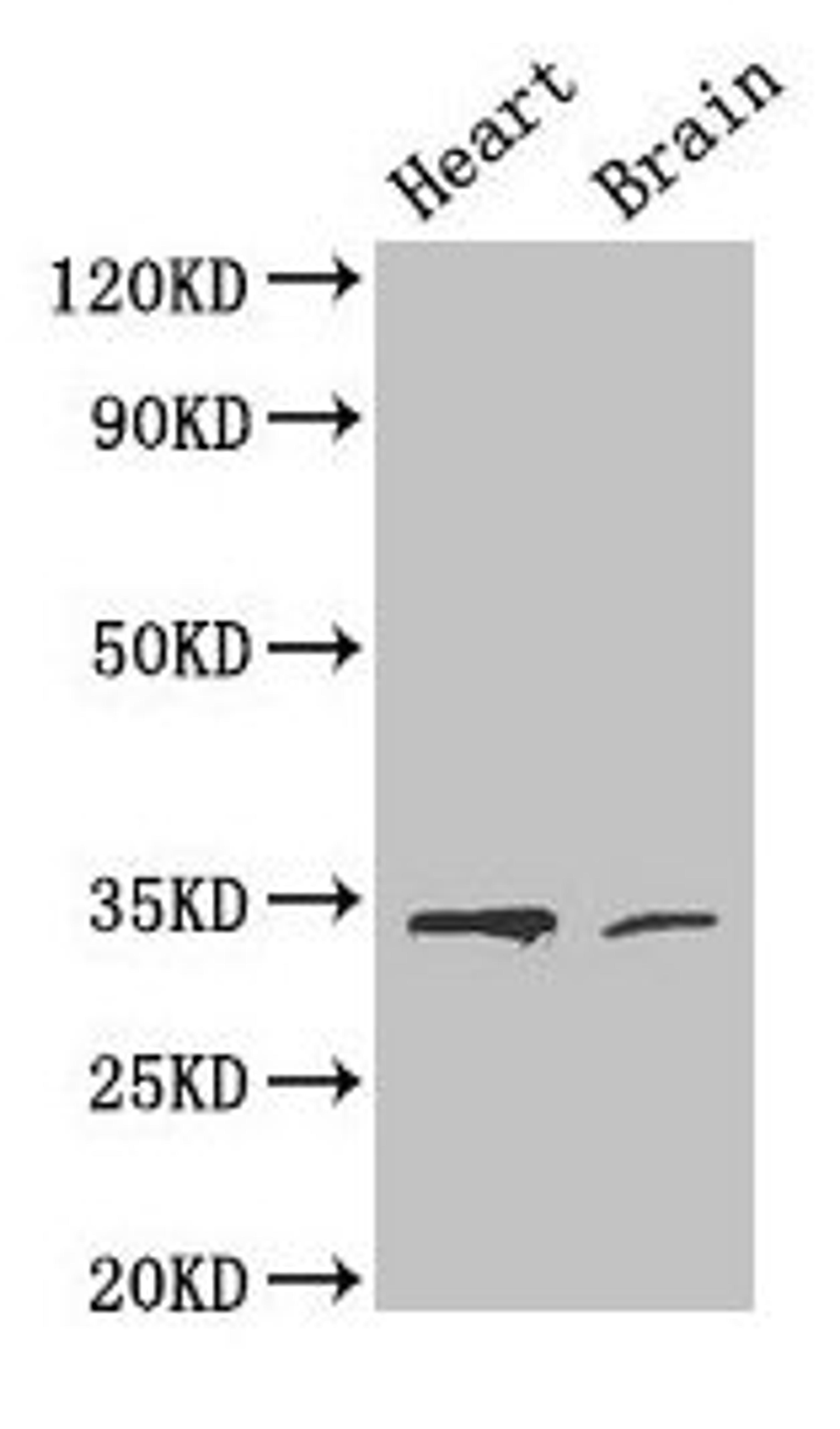 Western Blot. Positive WB detected in: Mouse heart tissue, Mouse brain tissue. All lanes: CDK5 antibody at 4µg/ml. Secondary. Goat polyclonal to rabbit IgG at 1/50000 dilution. Predicted band size: 34, 30 kDa. Observed band size: 34 kDa